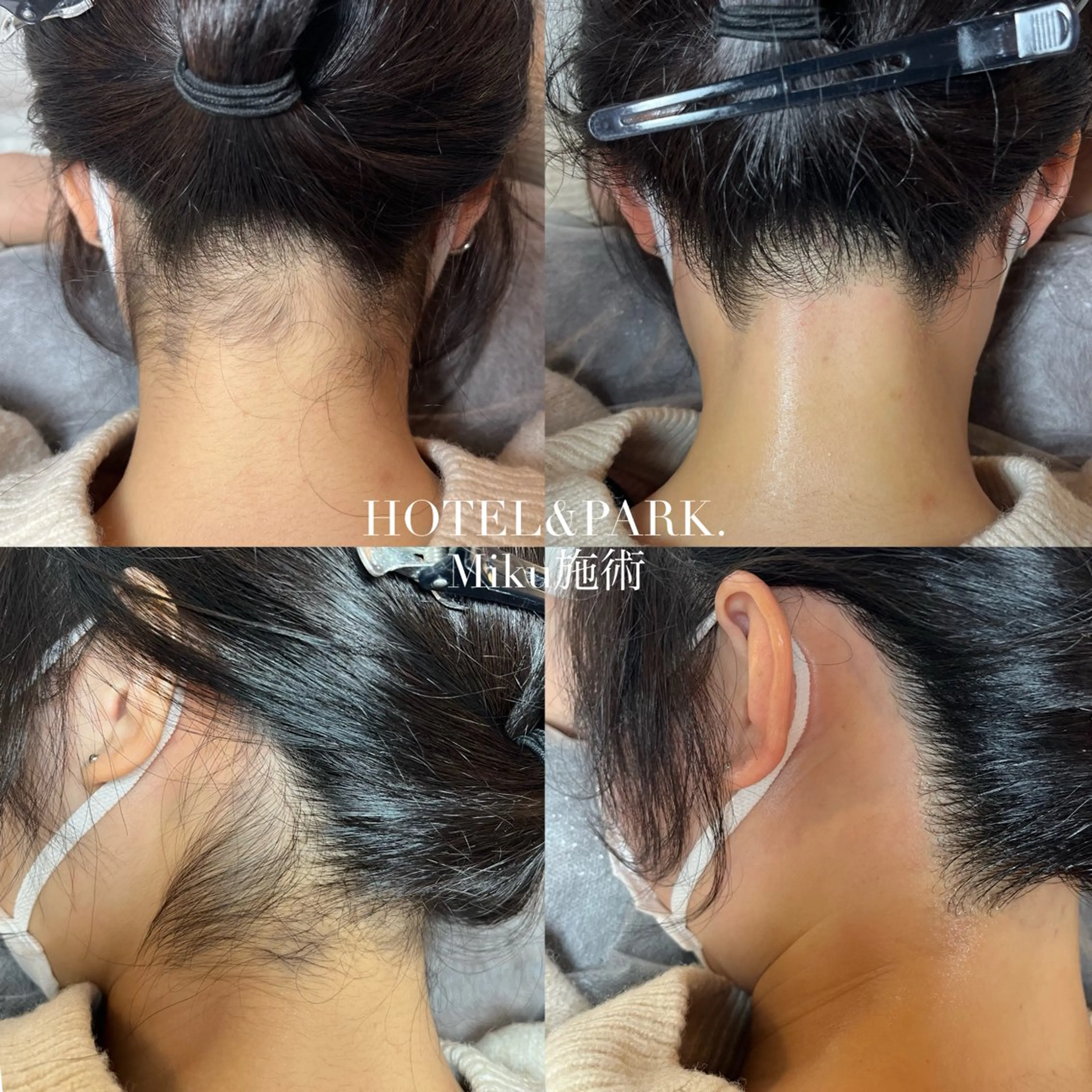 HOTEL&PARK Mikuワックス脱毛のエステ・リラクイメージ