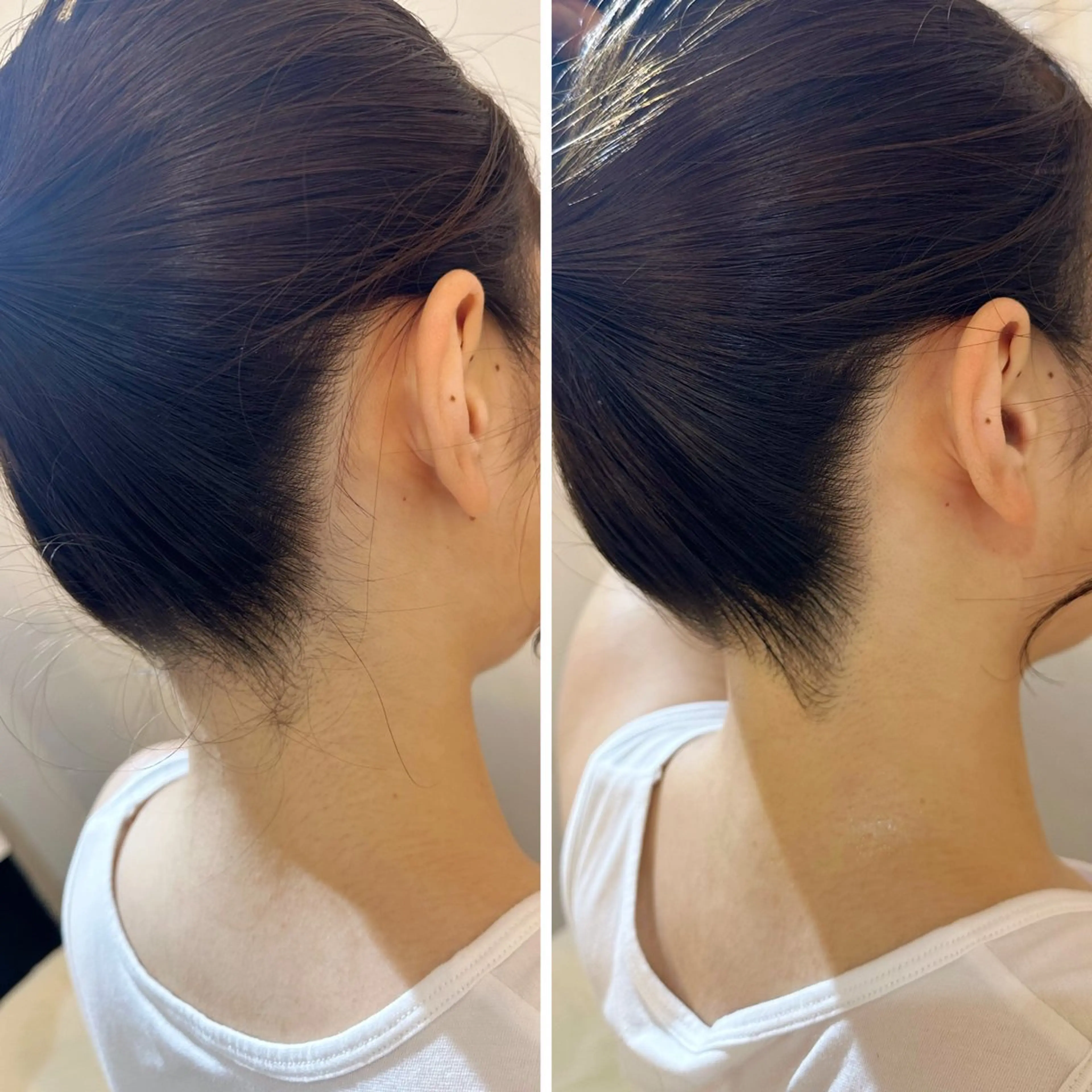 脱毛 うなじ脱毛/美肌脱毛 LABELのエステ・リラクイメージ