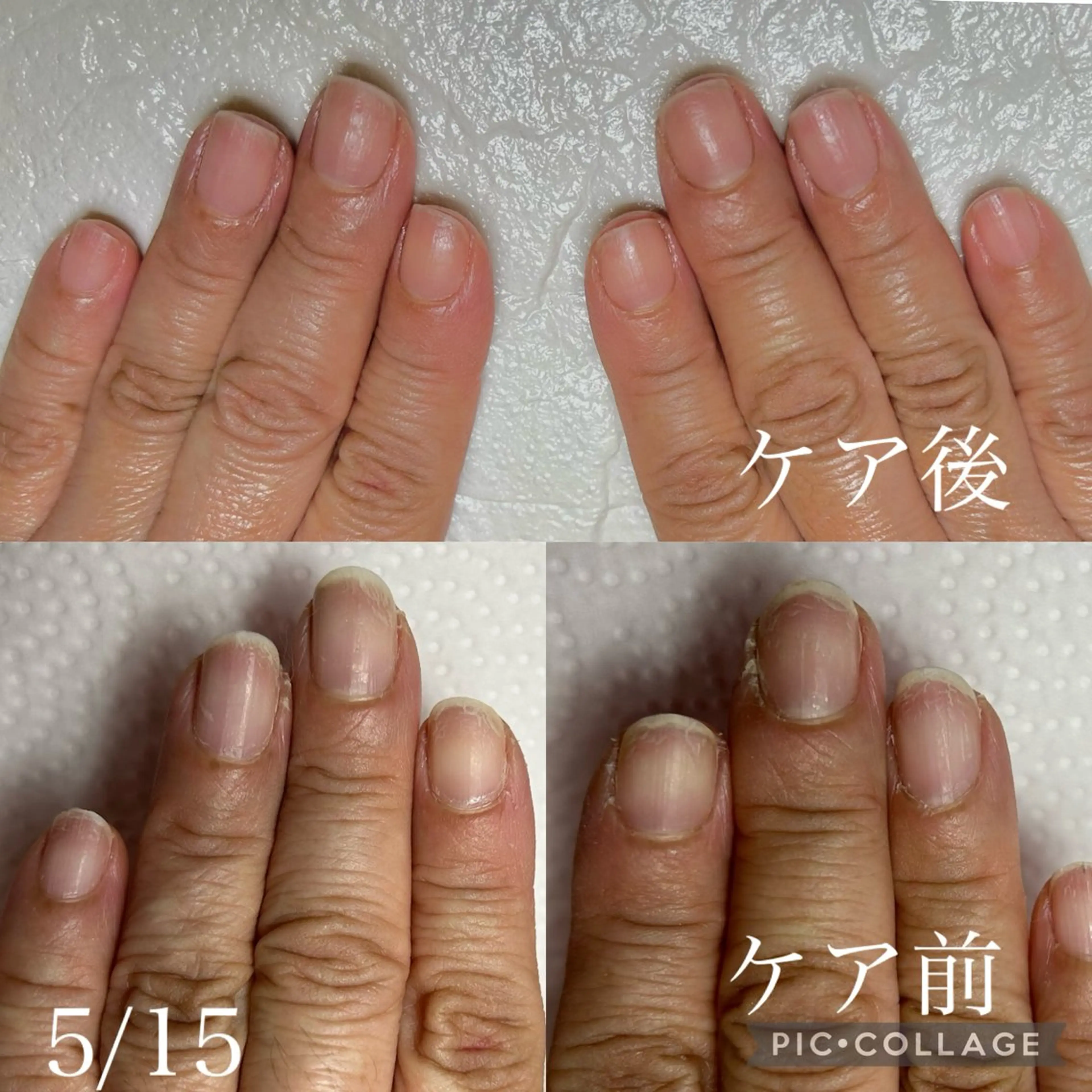 ネイル 深爪・自爪育成専門 MAHALOHIのネイルデザイン