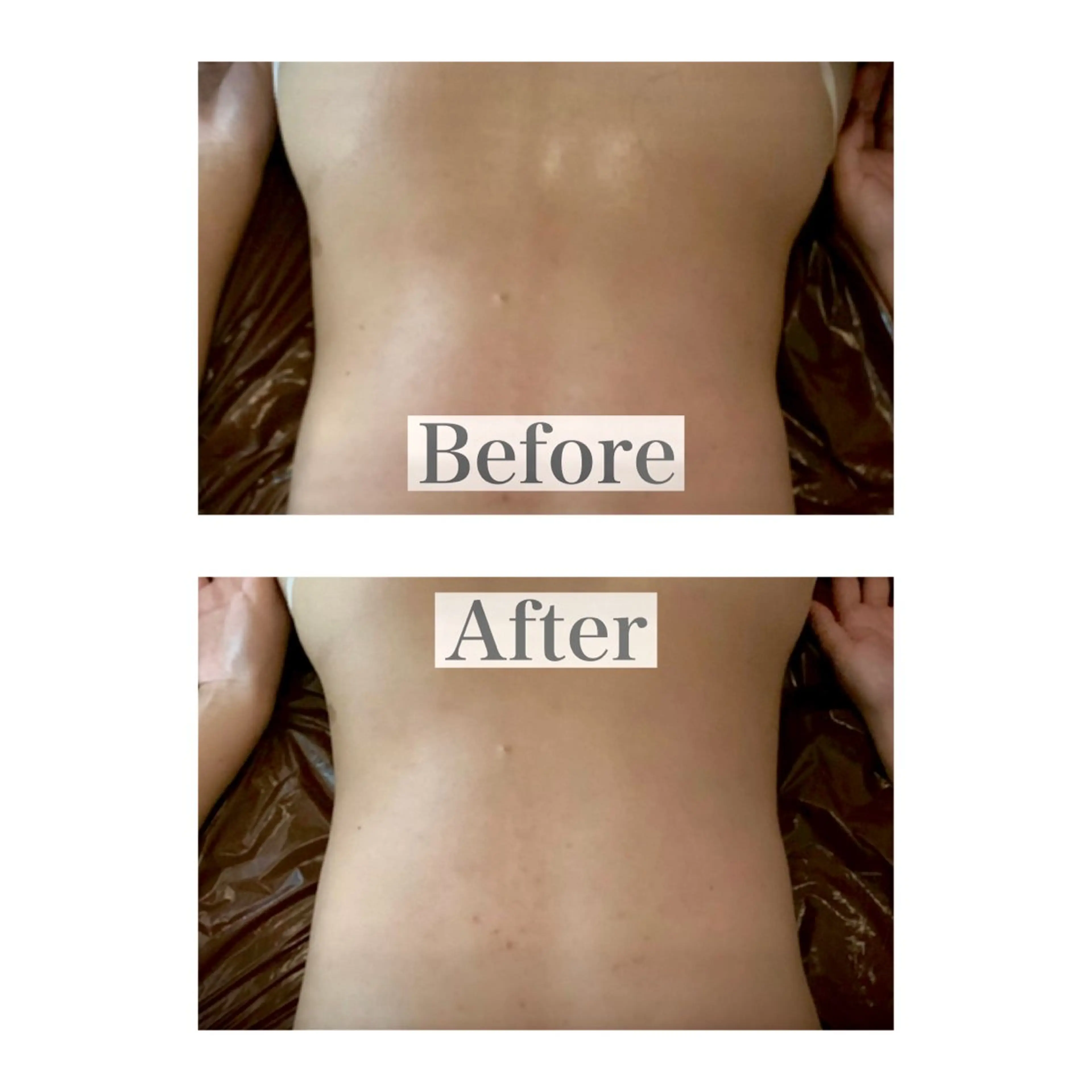 mooi【モーイ】所属・【北堀江】 痩身/小顔　mooiのエステ・リラクイメージ