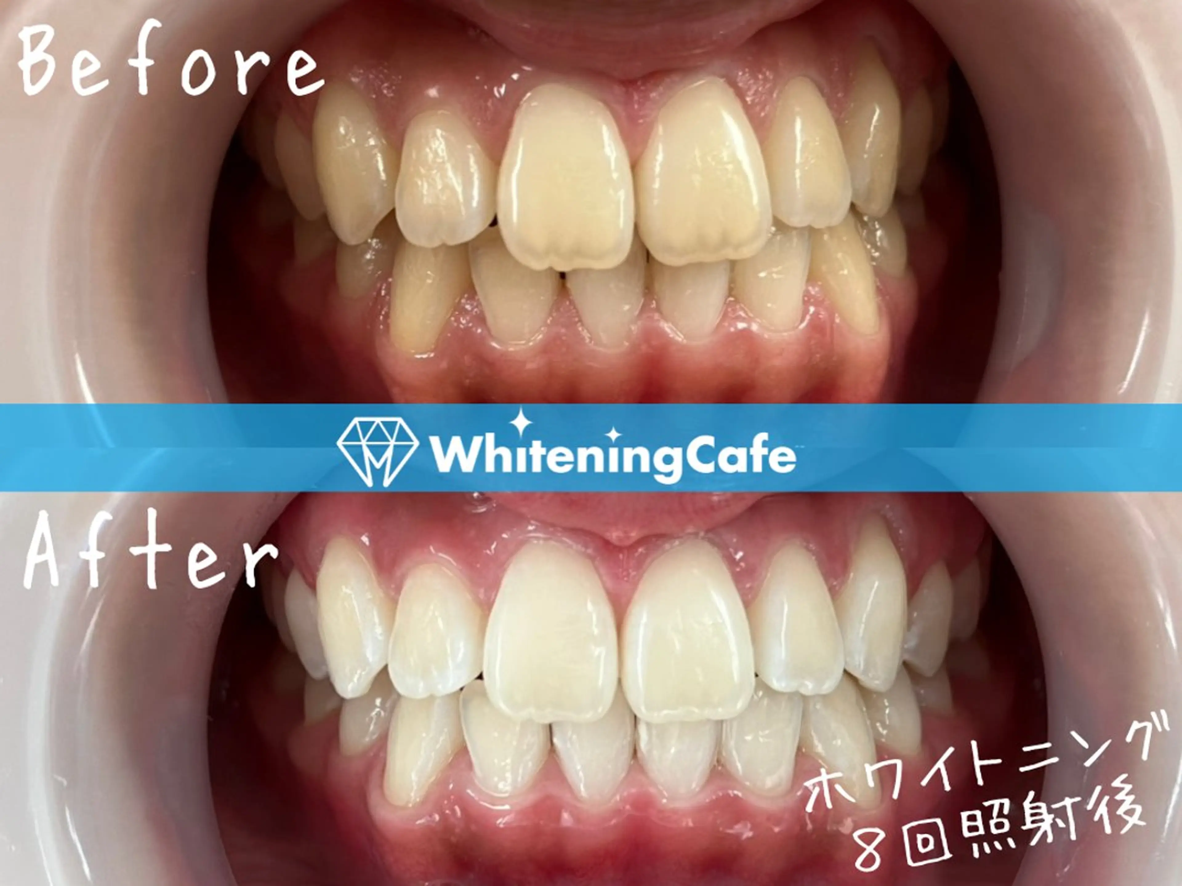 ホワイトニングカフェ徳島沖浜店所属・ホワイトニングカフェ 徳島沖浜店のエステ・リラクイメージ