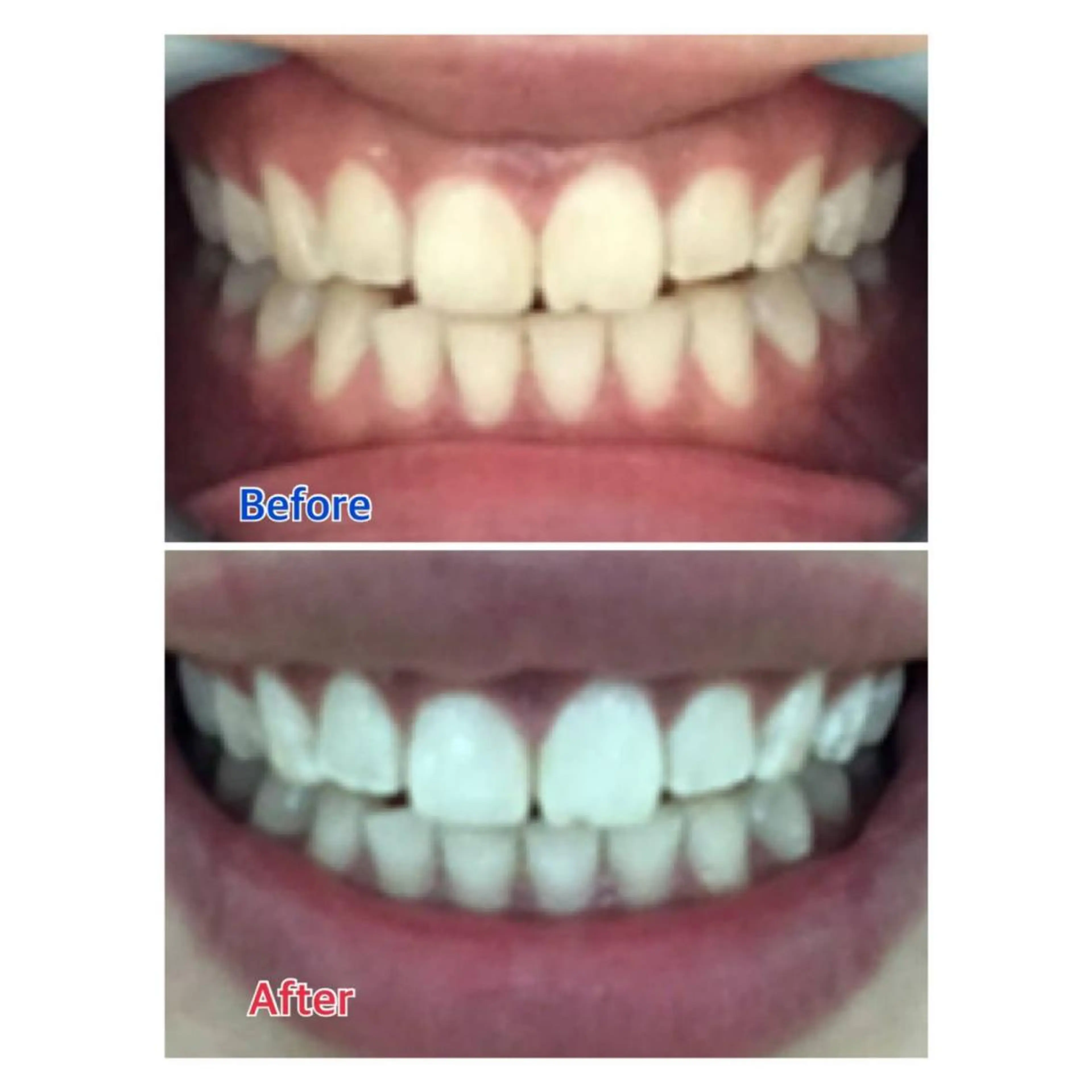 MBEAUTYSALON 千葉店・京成大久保所属・Melty 輝のその他イメージ