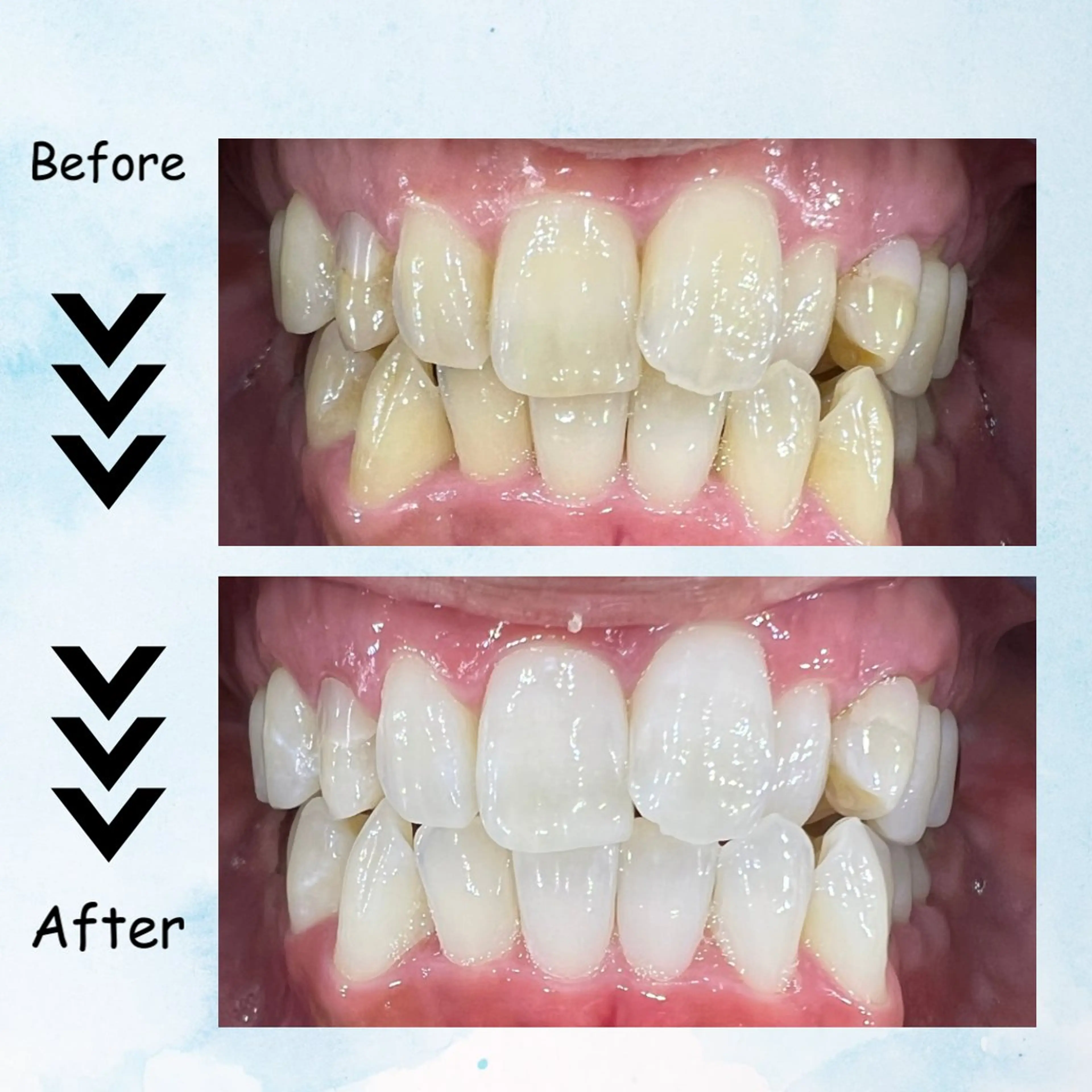 メンズ その他 セルフホワイトニング エクシア塩釜口駅前店所属・セルフホワイトニング エクシア塩釜口駅前店のその他イメージ