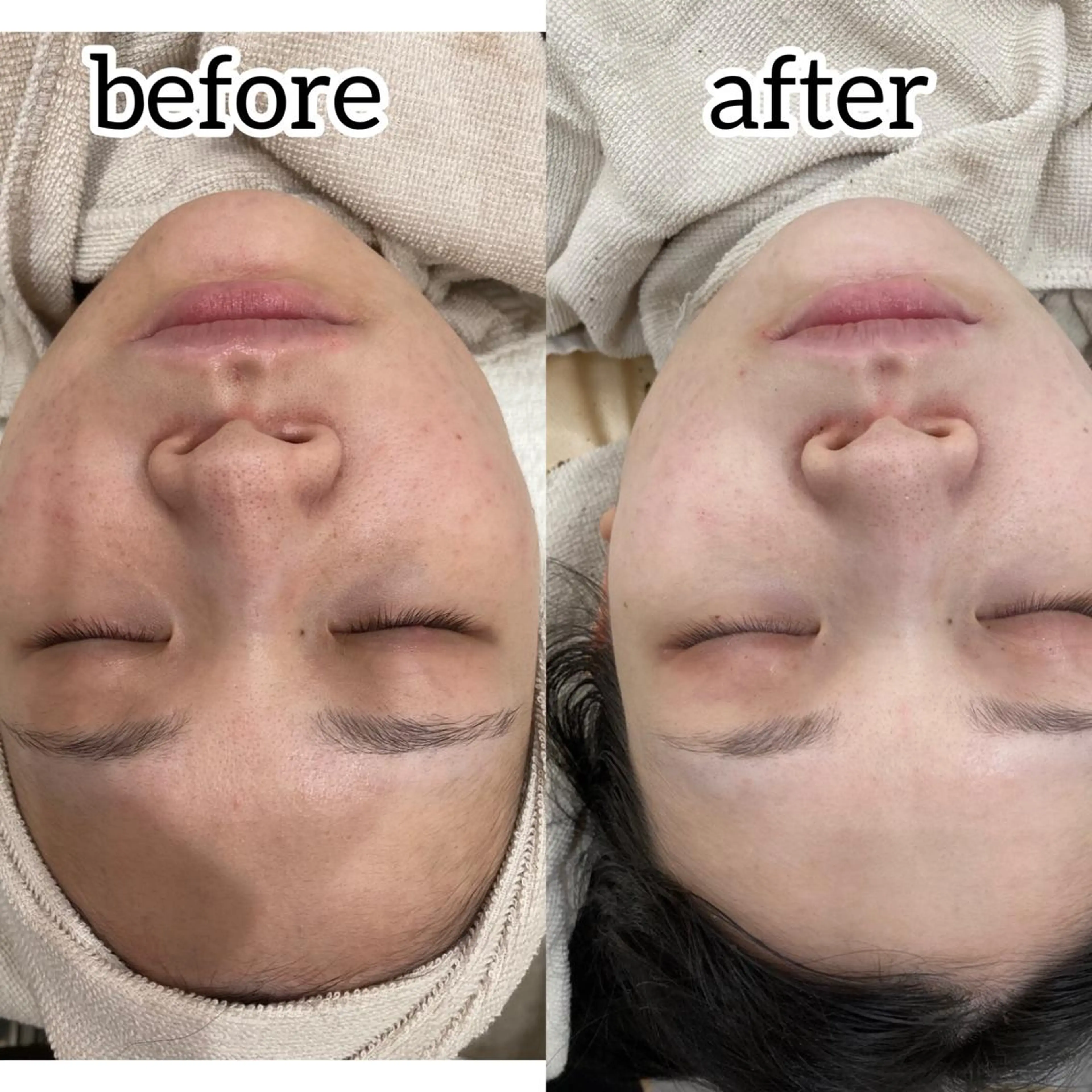 laluna saki...のその他イメージ