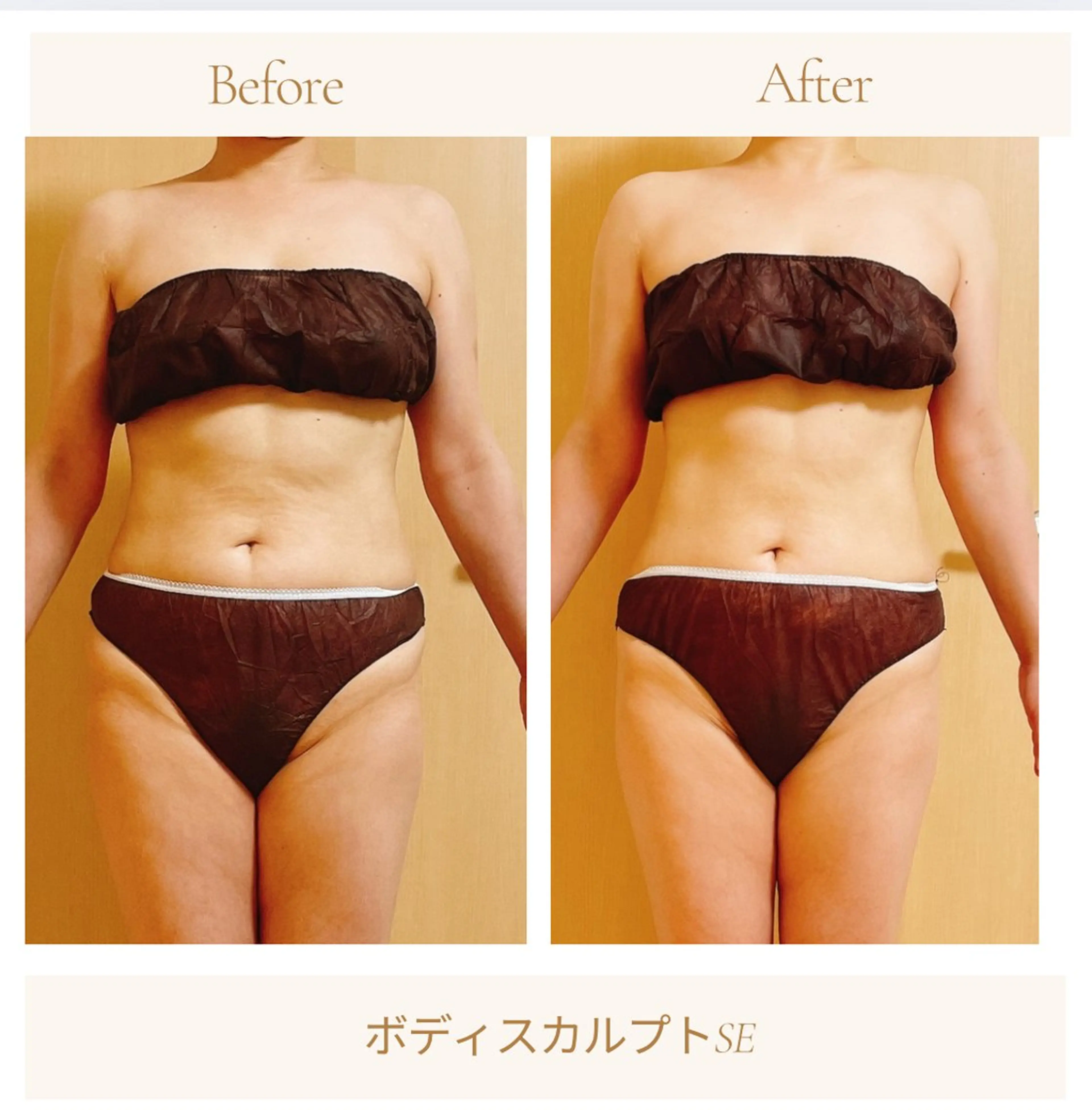 小顔・デトックスリンパ専門サロンRadiant Muse (ラディアントミューズ)所属・小顔・たるみ改善 ラディアントミューズのエステ・リラクイメージ