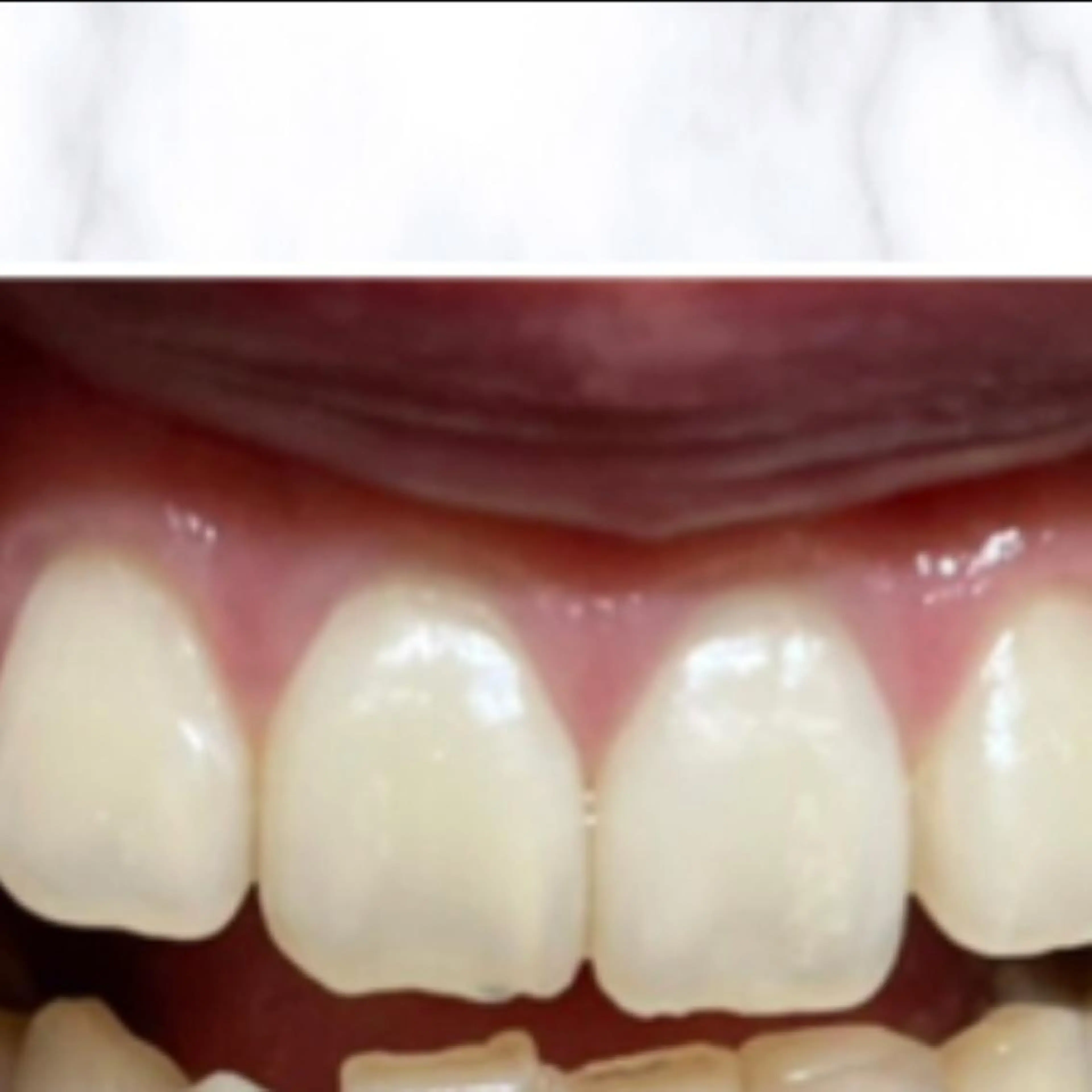 その他 ライトケアサロン 渋谷店② 渡邊のその他イメージ