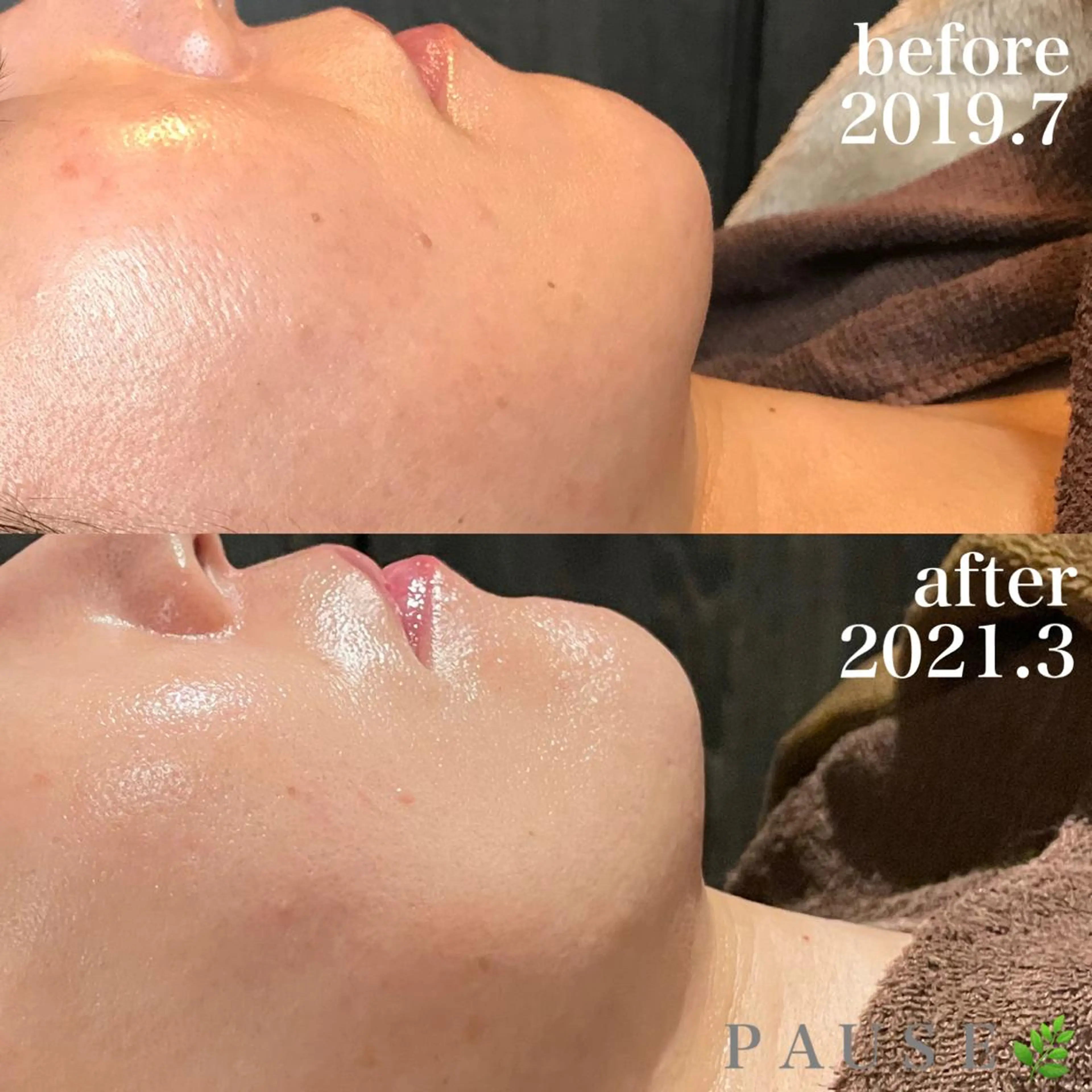 エステ 浜野 恵美のエステ・リラクイメージ