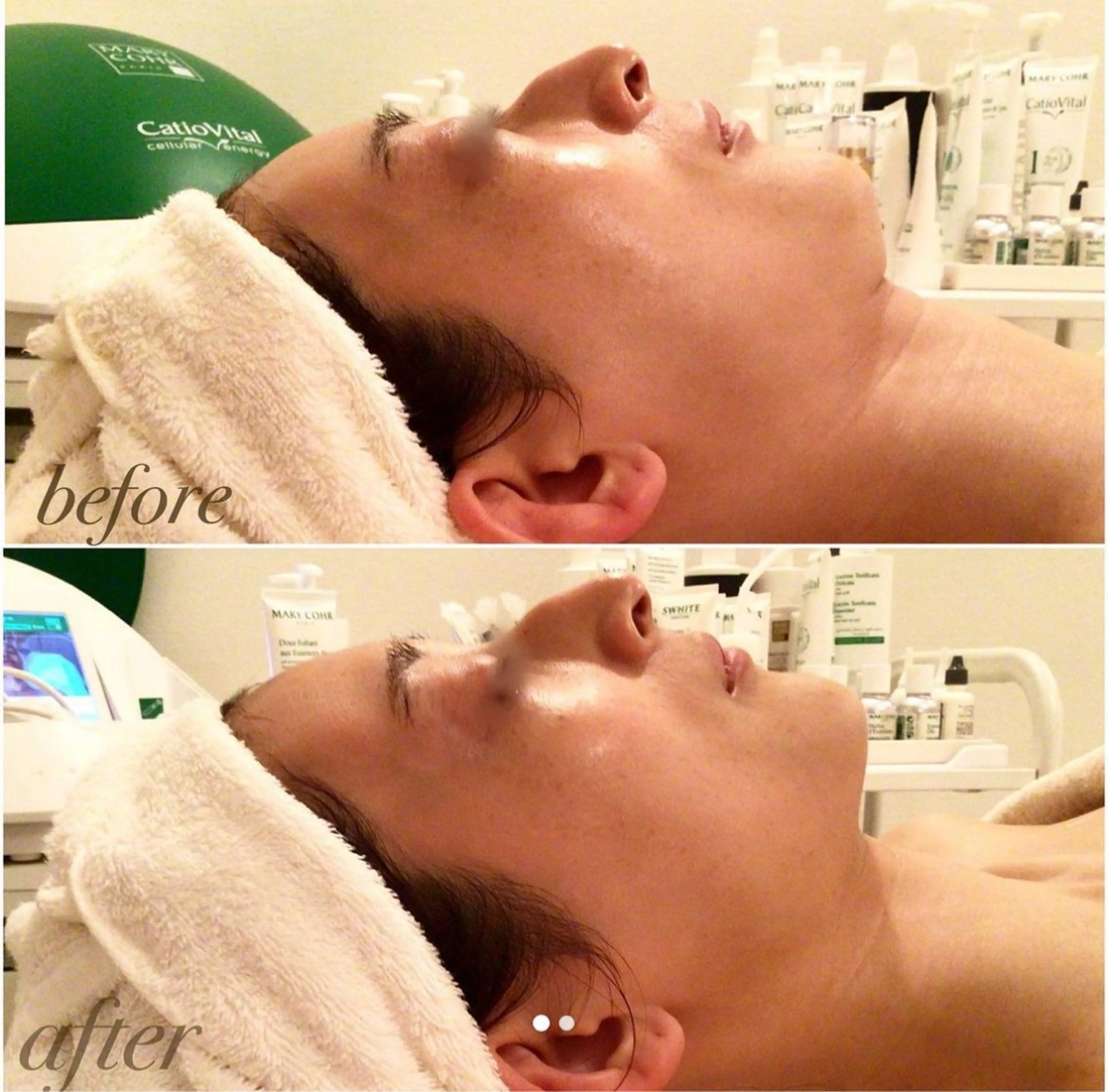 国際認定エステサロン ホワイトカメリアのエステ・リラクイメージ