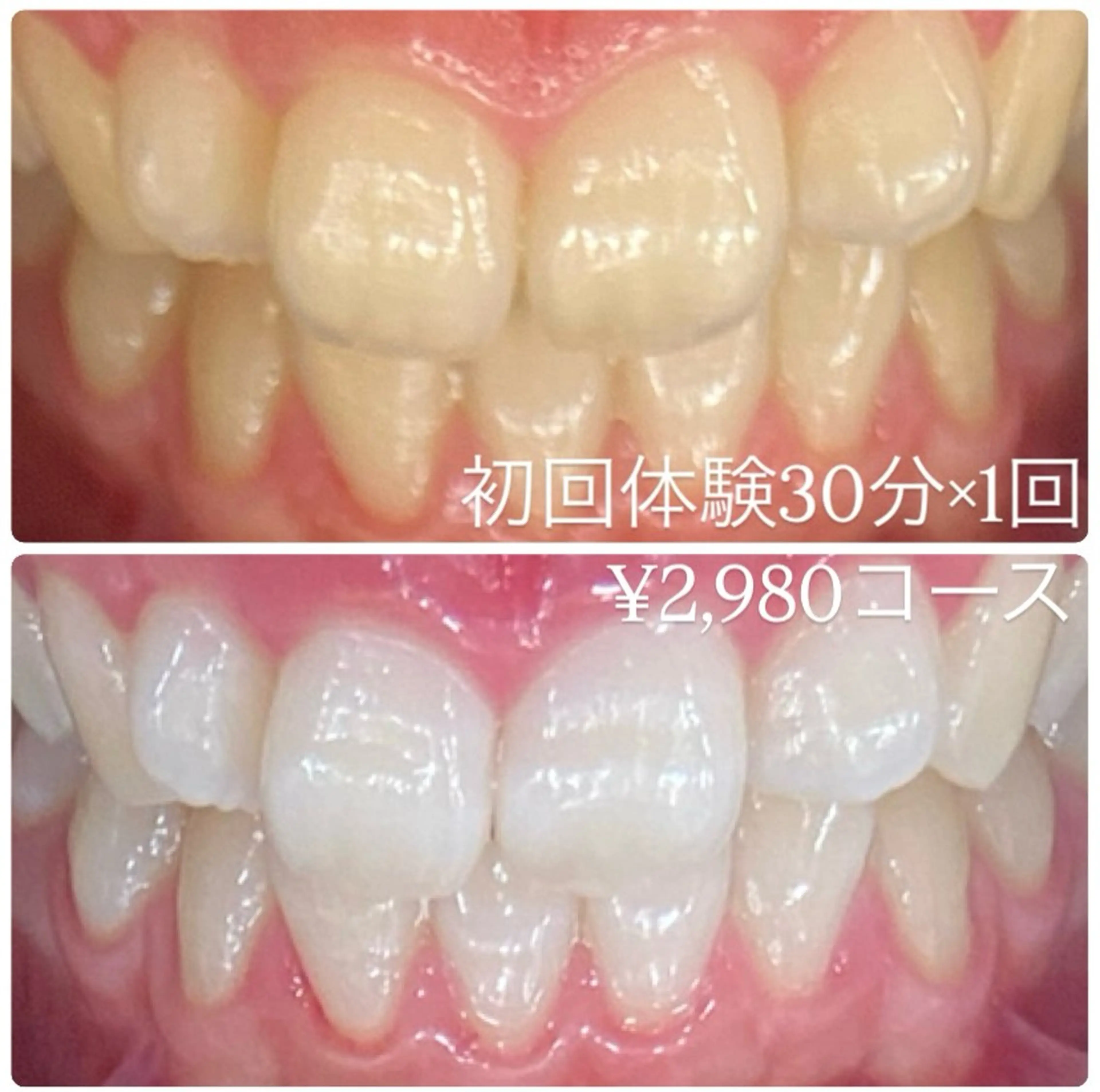 PLATINUM Beauty 横浜店所属・ホワイトニングルーム 横浜店のその他イメージ