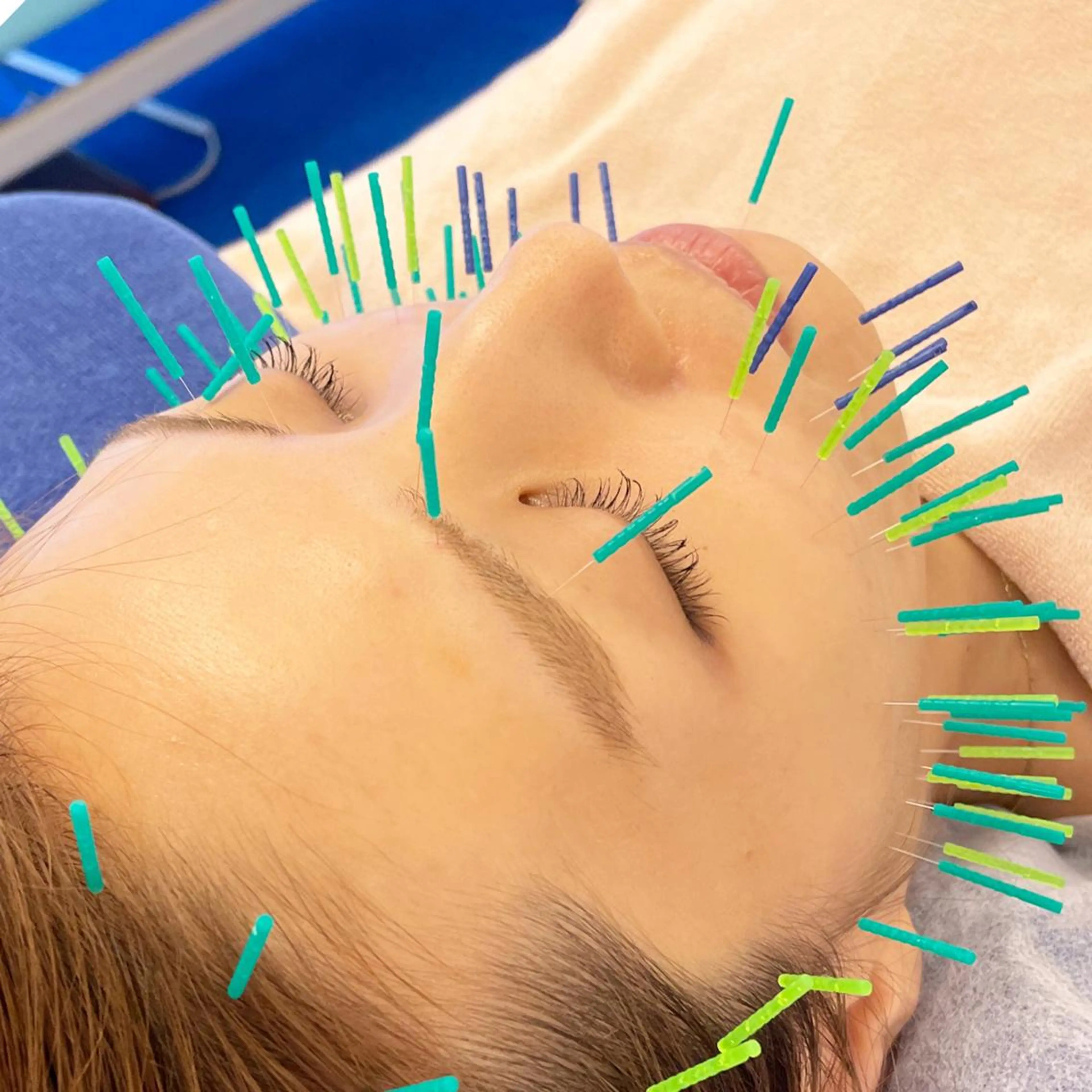 小顔美容鍼専門サロン 渋谷YZのその他イメージ