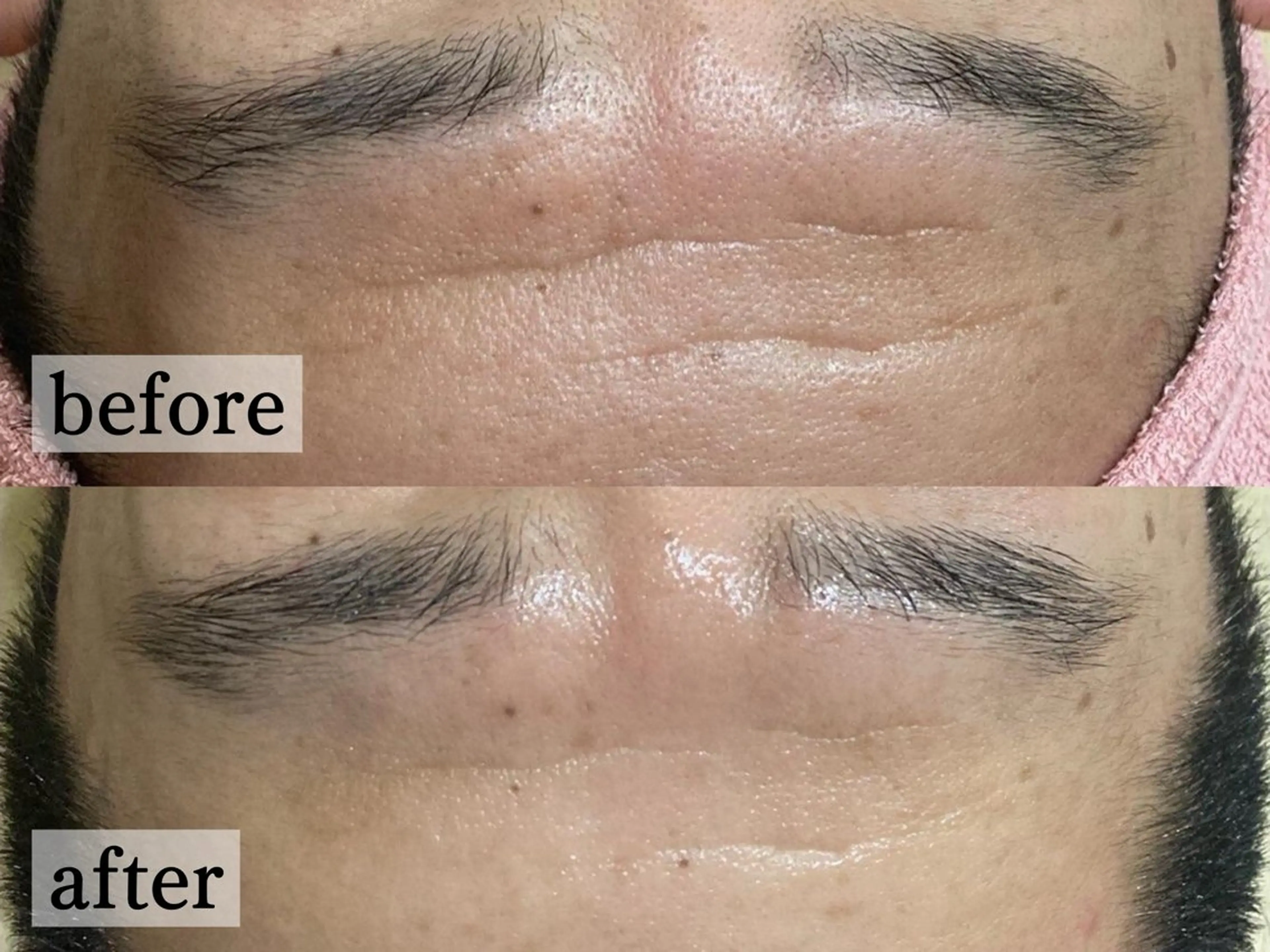 エステ フェイシャル/脱毛 ジョアアンジェ竹田のエステ・リラクイメージ