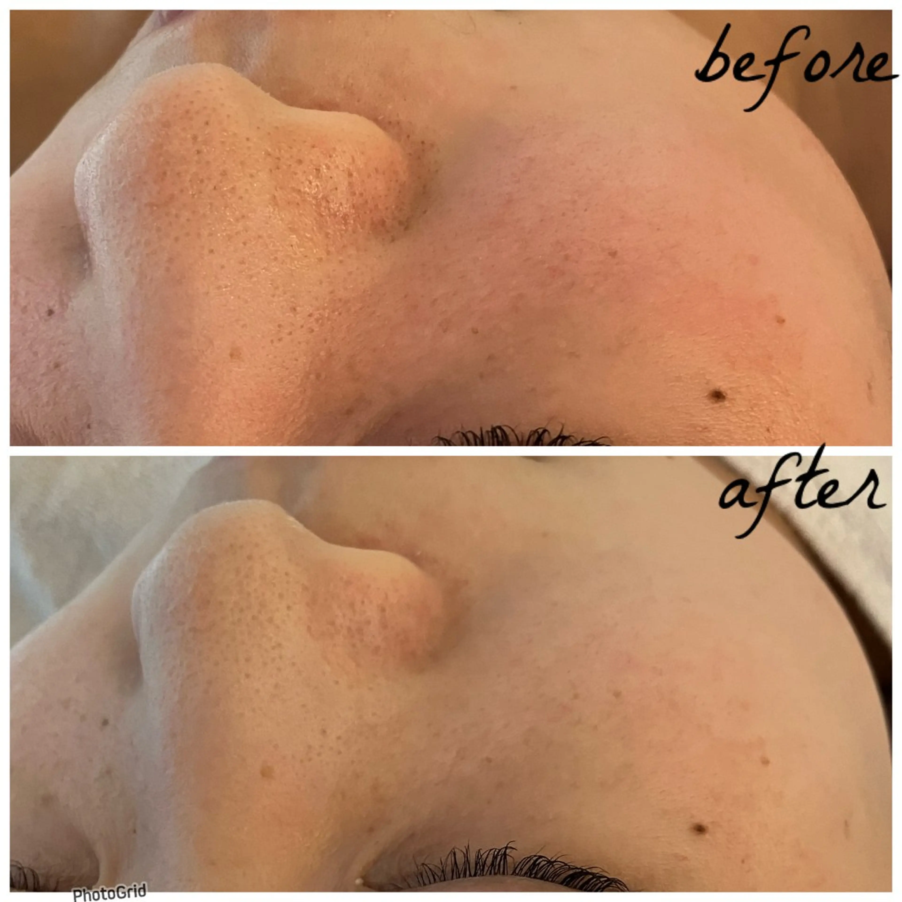 メンズ メナード岐阜茜部 杉浦のエステ・リラクイメージ