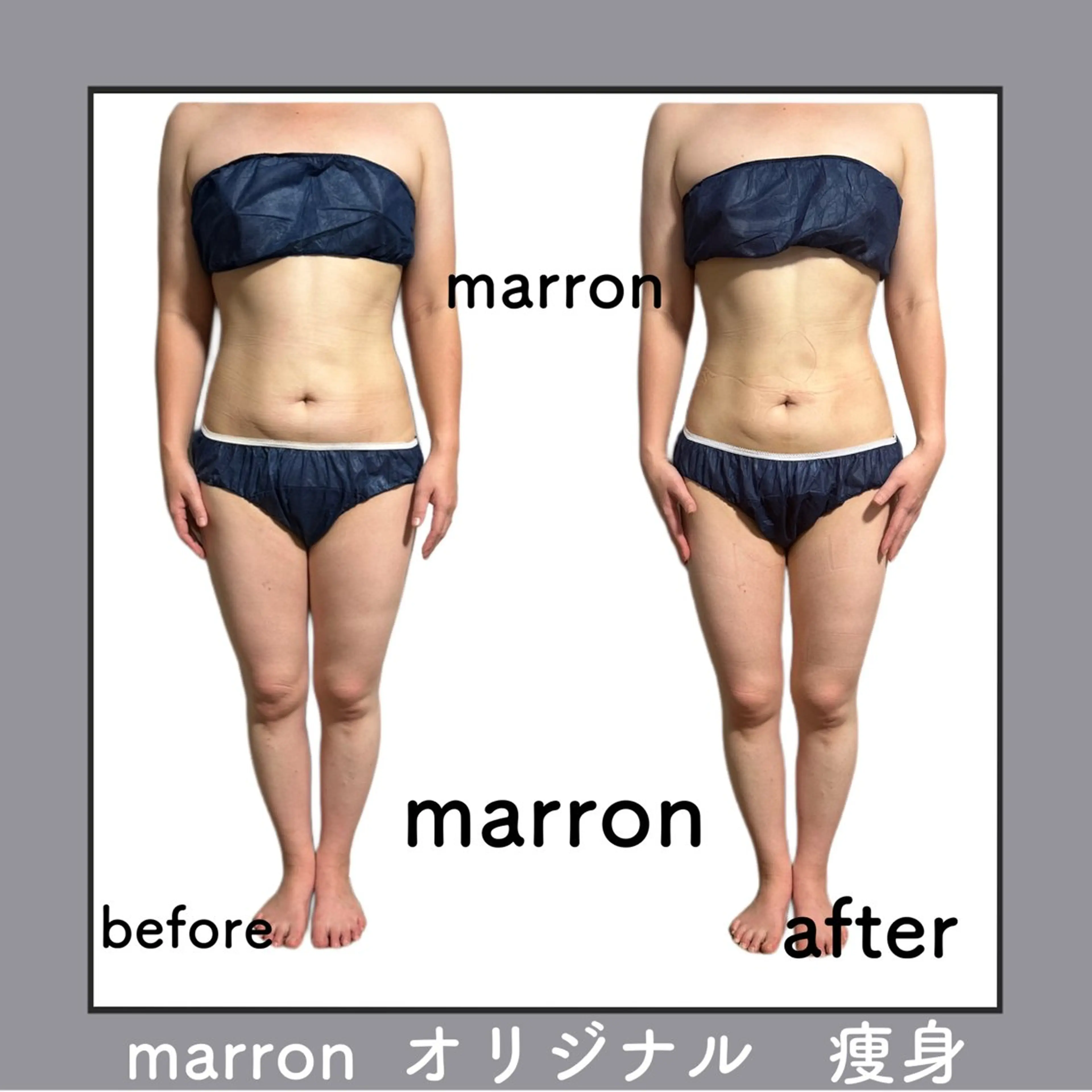 marron所属・痩身ハイパーナイフ ララピールリアボーテのエステ・リラクイメージ