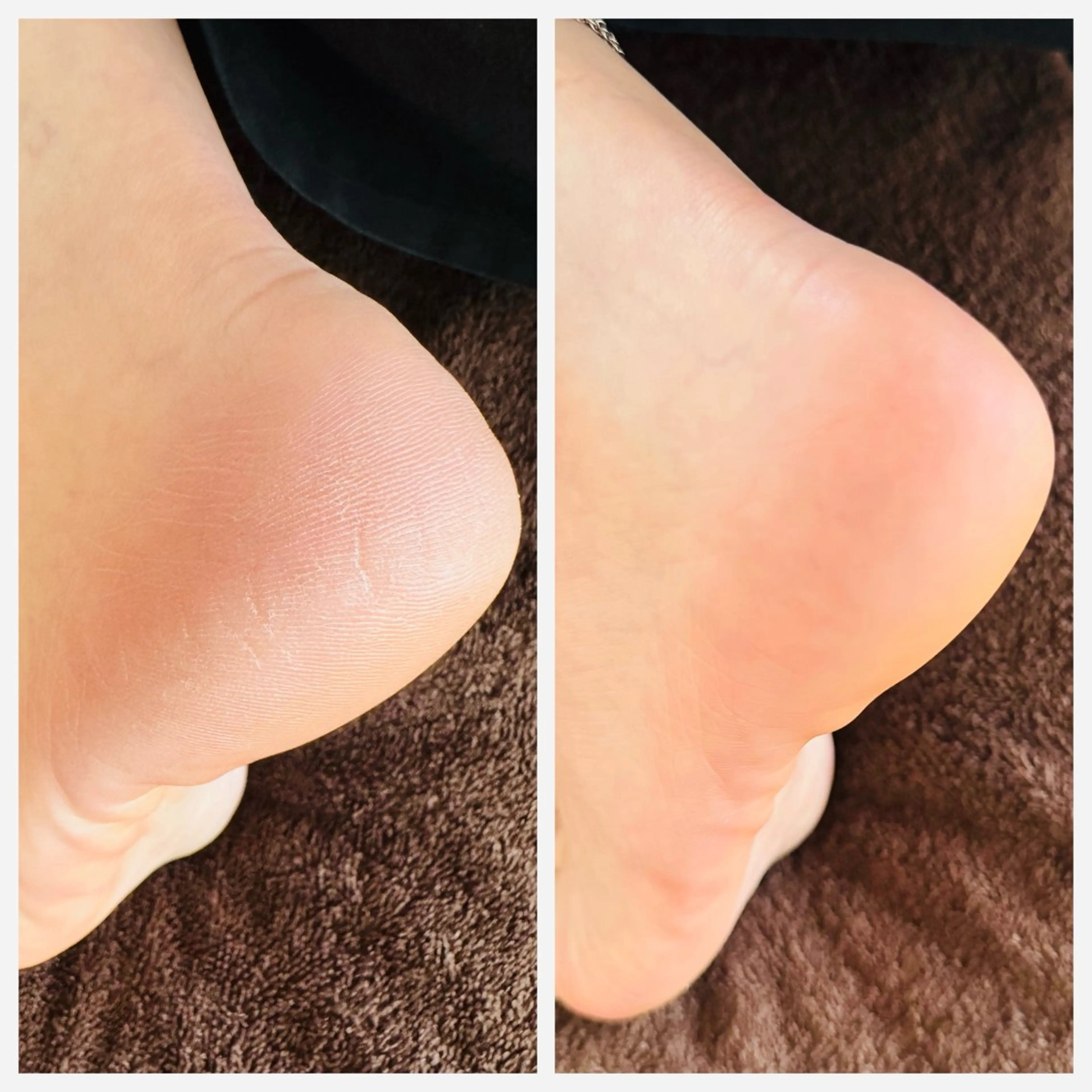 その他(ネイル) chou. chouのエステ・リラクイメージ