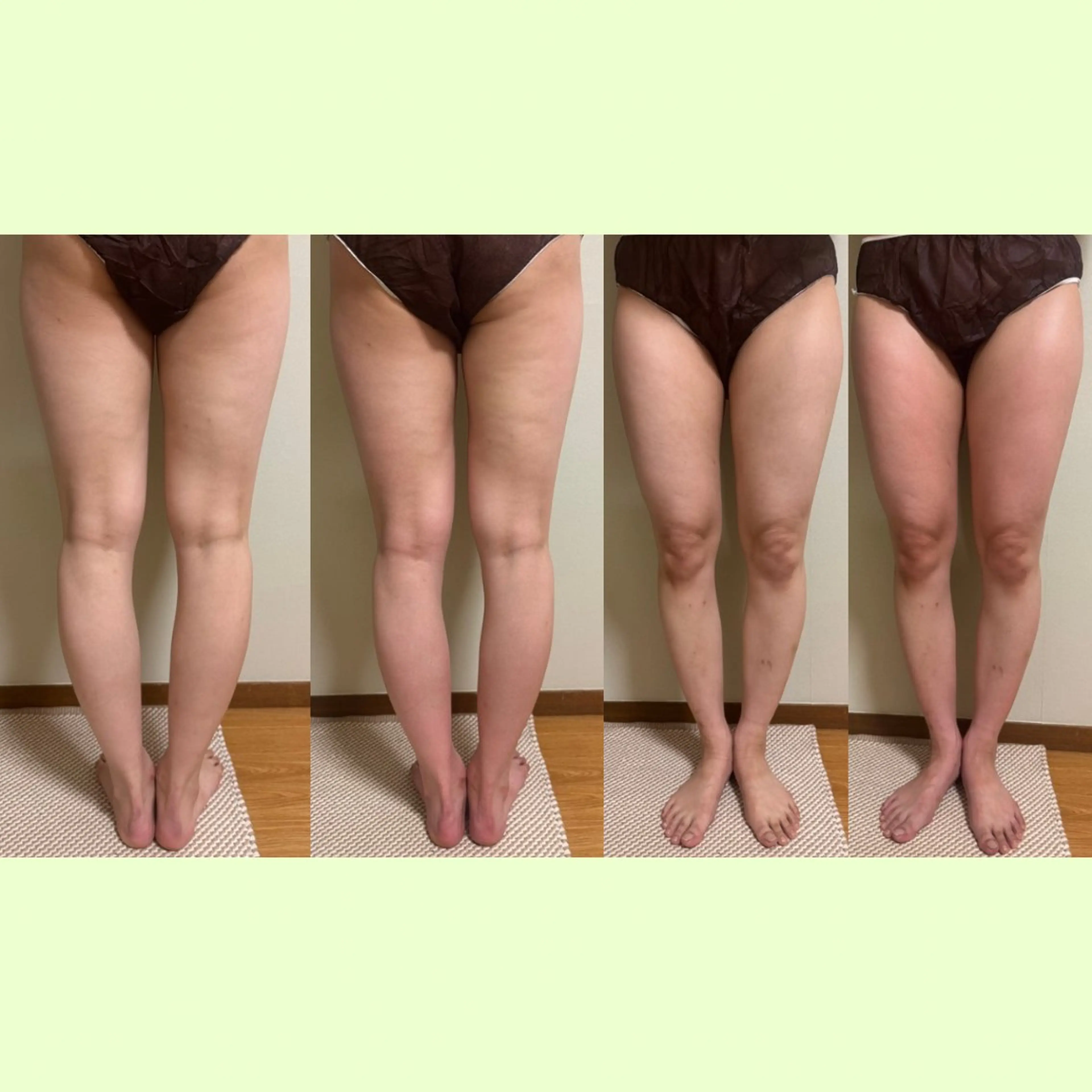 リラクゼーションスパ　ひのき所属・spaHINOKI 【女性専用】のエステ・リラクイメージ