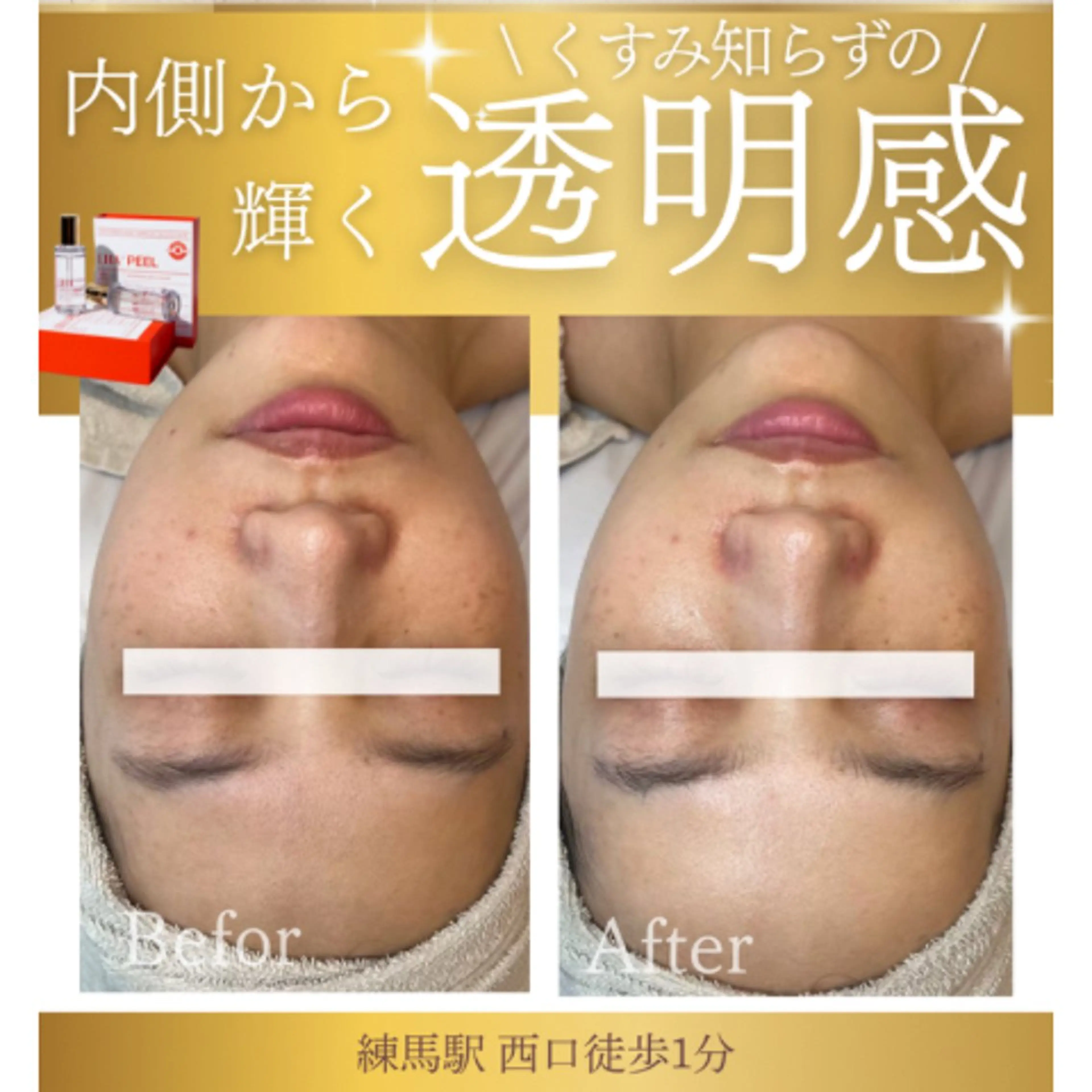 韓国肌管理/毛穴洗浄 💎ぷるる練馬/山口のエステ・リラクイメージ