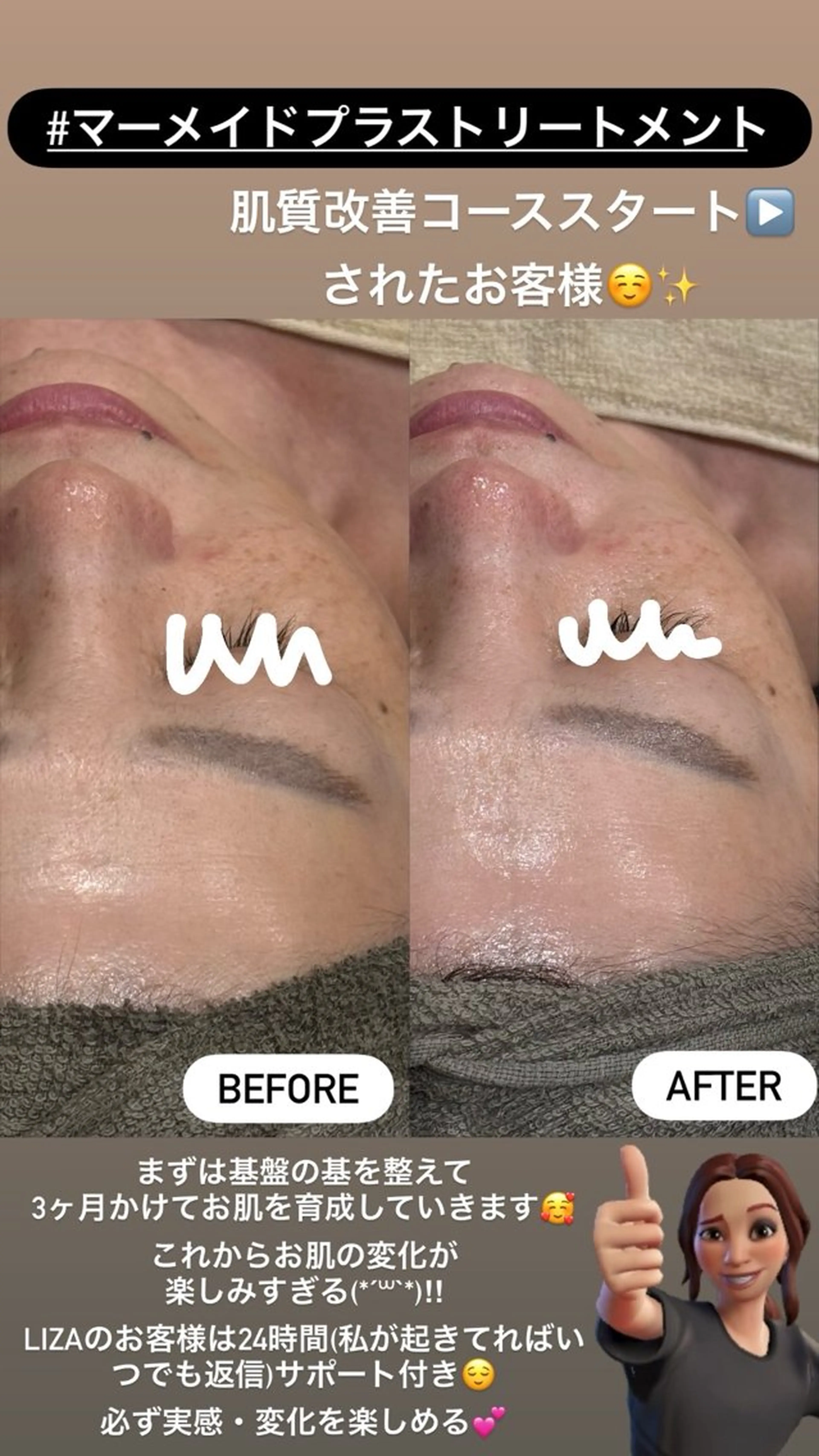 エステ LiZA エステティックサロンのエステ・リラクイメージ