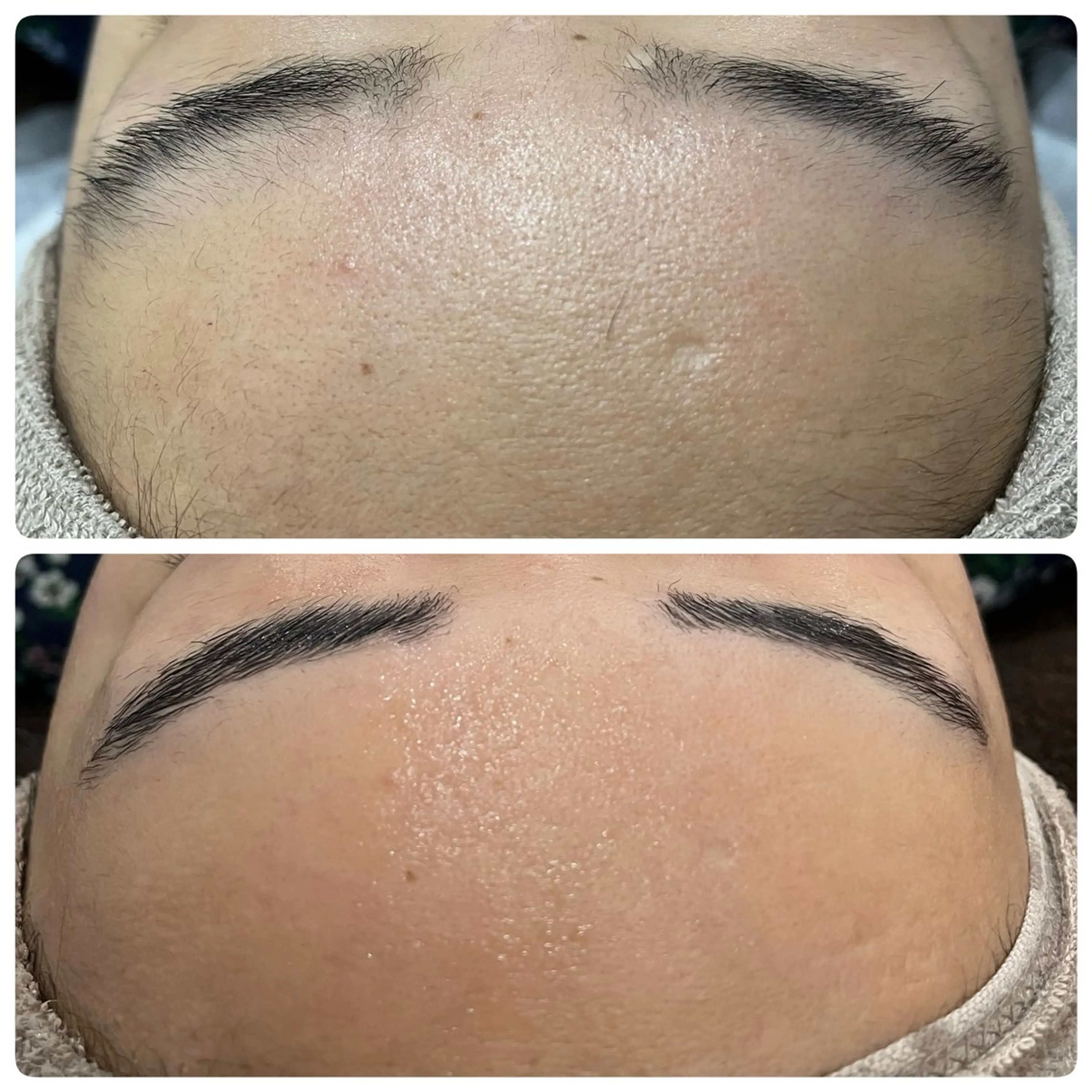 エステ A"-HILU(アーヒル)所属・A"-HILU （アーヒル)のエステ・リラクイメージ