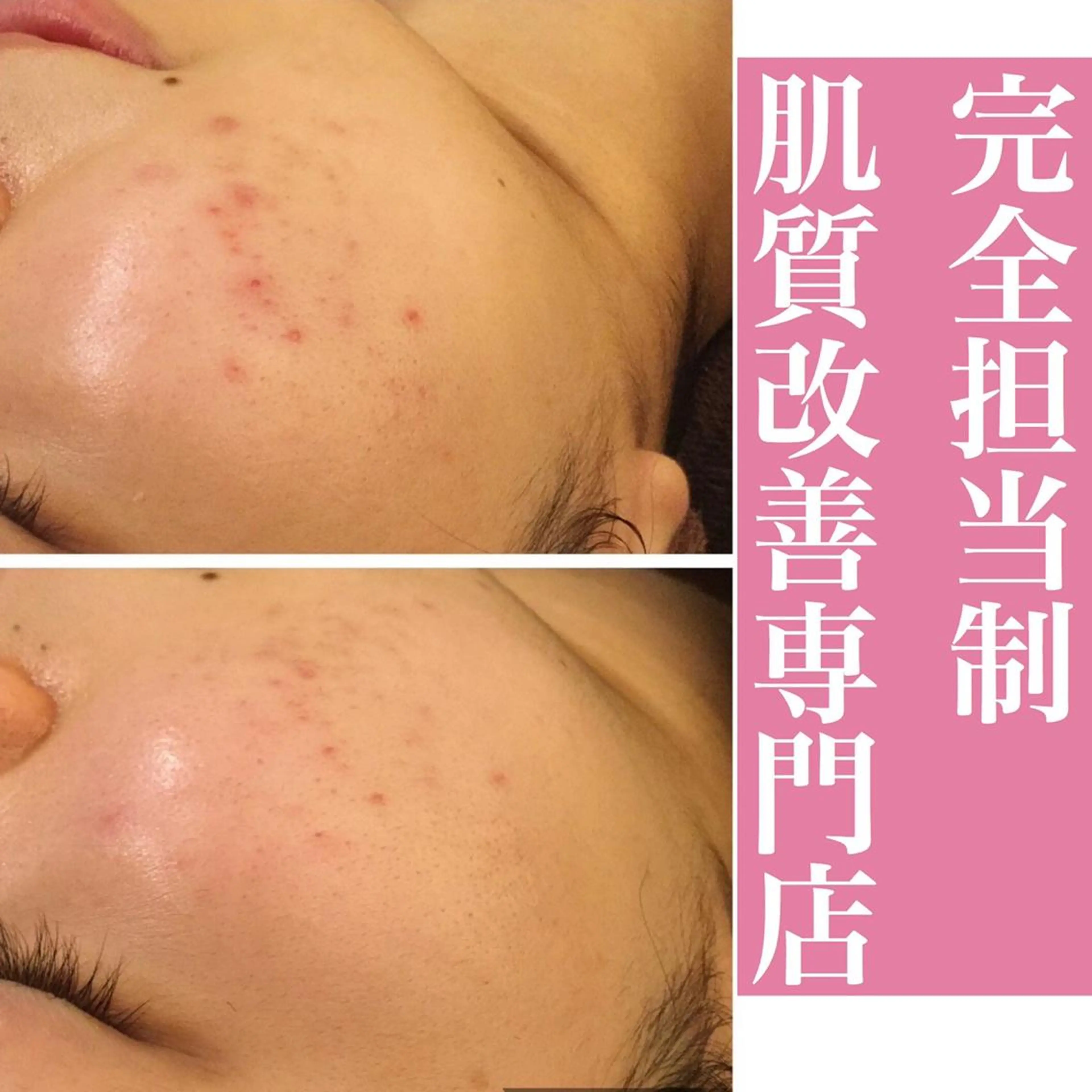 ミディアム カラー パーマ ヘアアレンジ メンズ キッズ ネイル マツエク・マツパ アイブロウ ニキビ・肌質改善専門 ♡人生が変わるサロンのエステ・リラクイメージ