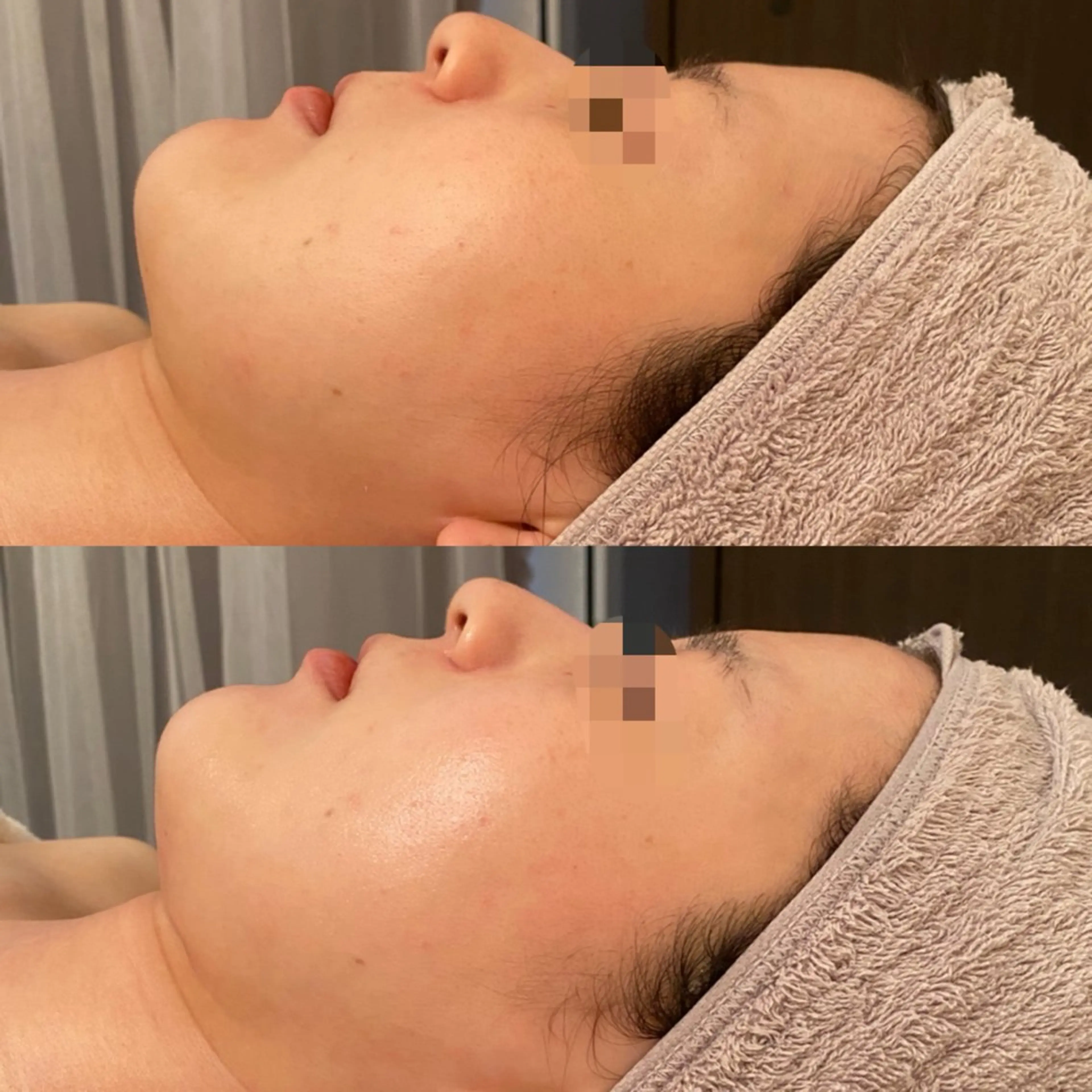 エステ リラク 田中For..天王寺 肌質改善/よもぎ蒸しのエステ・リラクイメージ