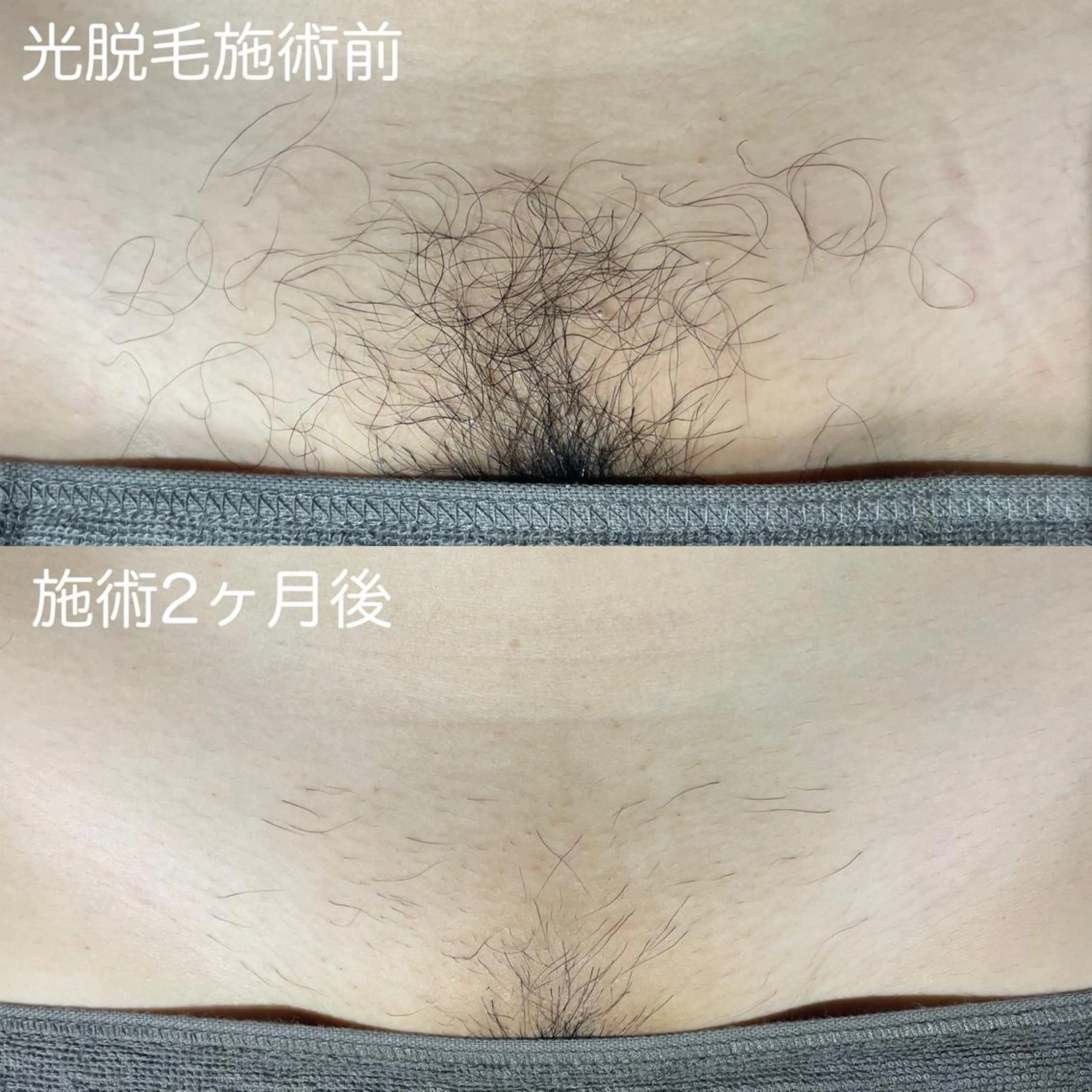 メンズ 脱毛 a laise 斉藤(表参道)のエステ・リラクイメージ