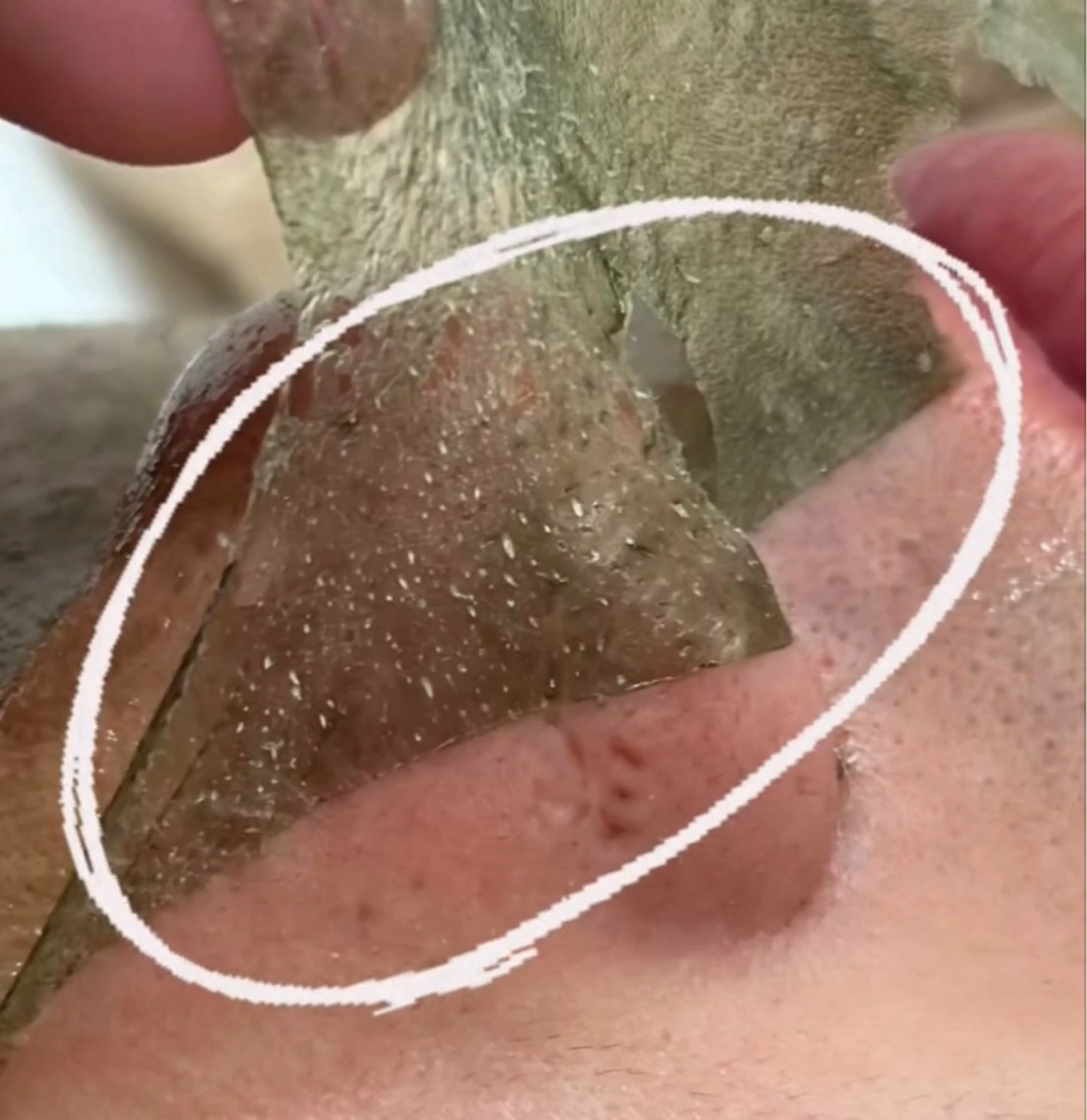 【リピーター✨艶美肌】新フラワーハーブピーリング💐ダウンタイム無し！角栓やザラつき、繰り返す肌トラブルの改善に✨の写真