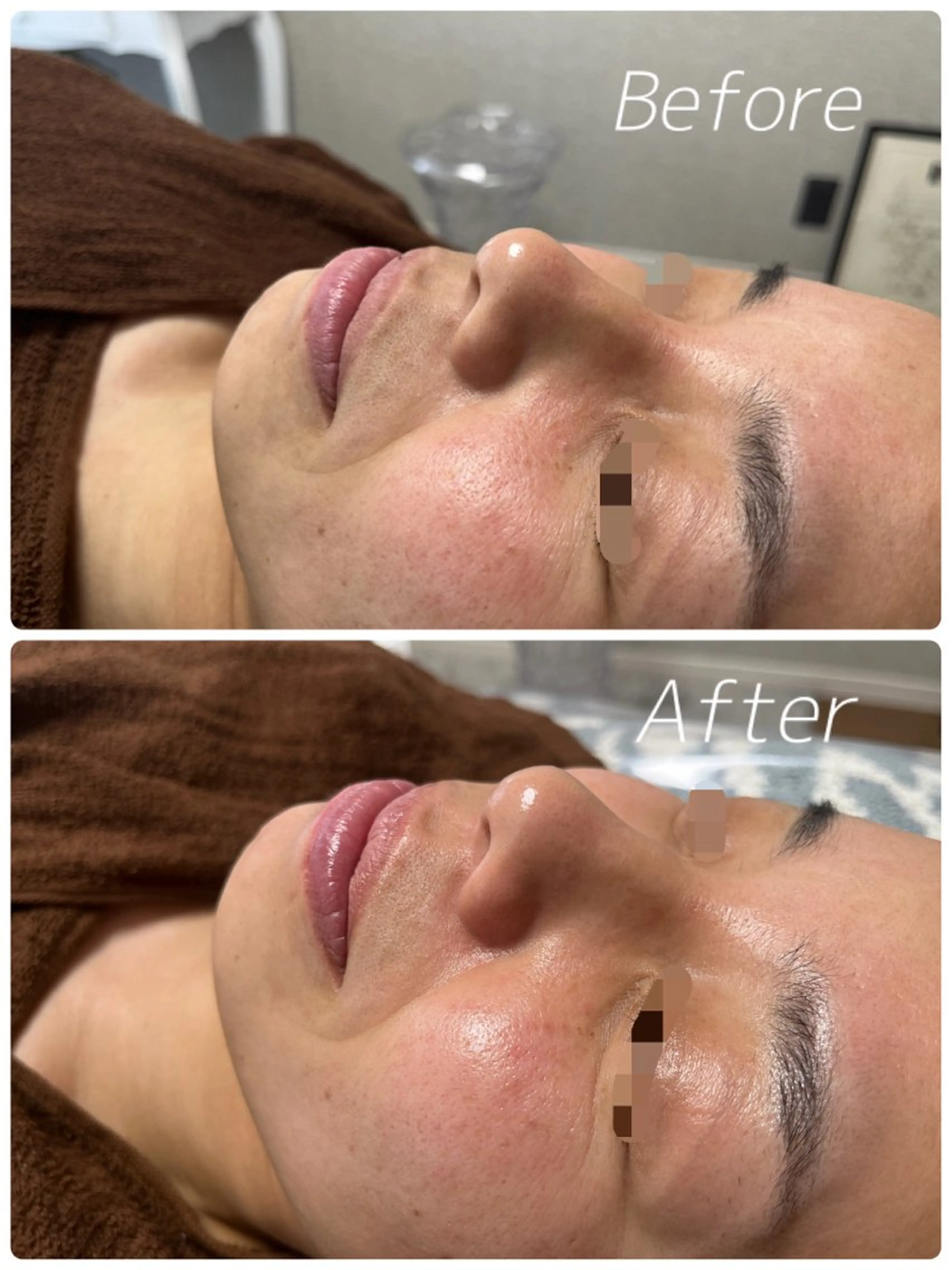 アンシャンテ トータルビューティーのエステ・リラクイメージ