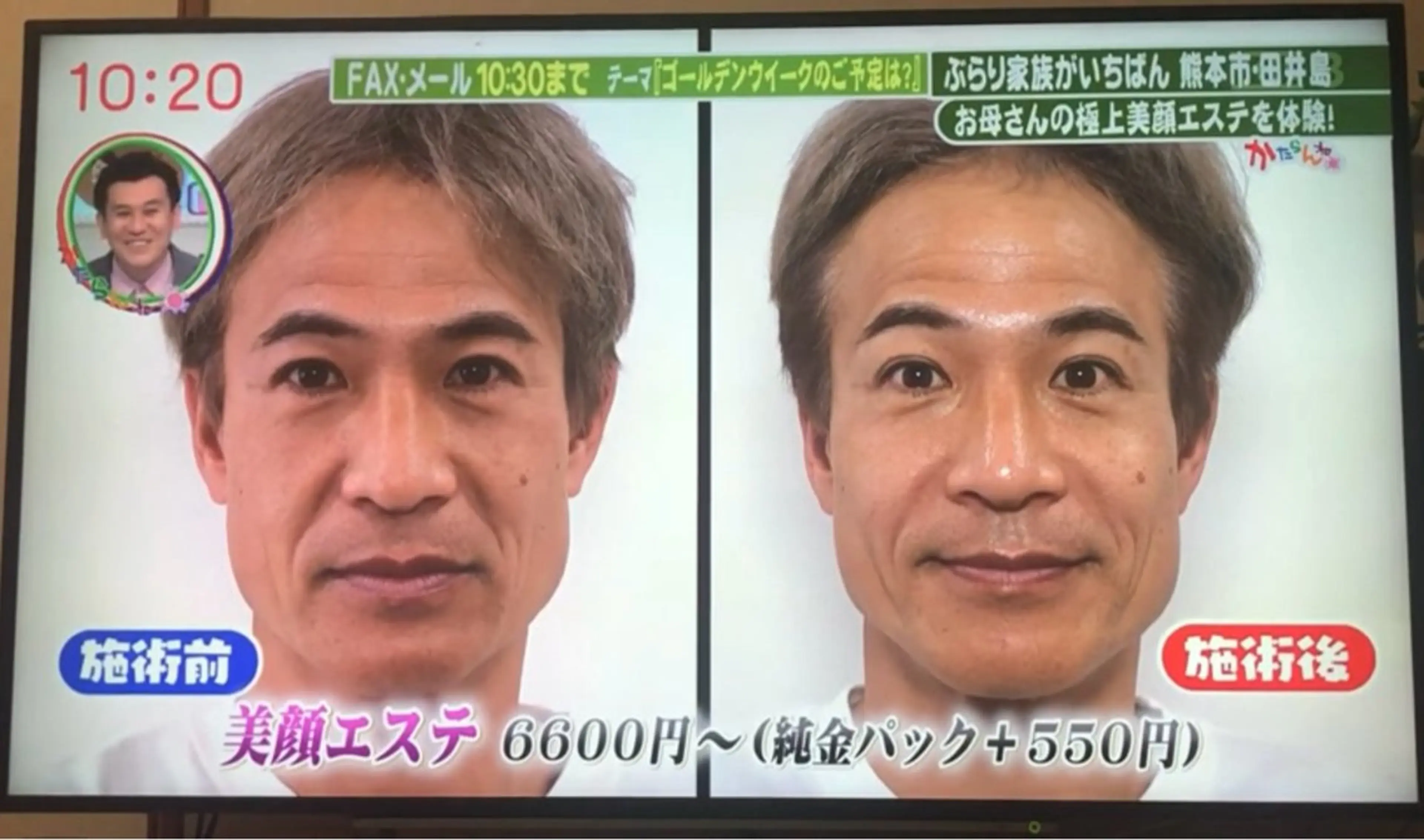 エステ エステサロン トムズのエステ・リラクイメージ