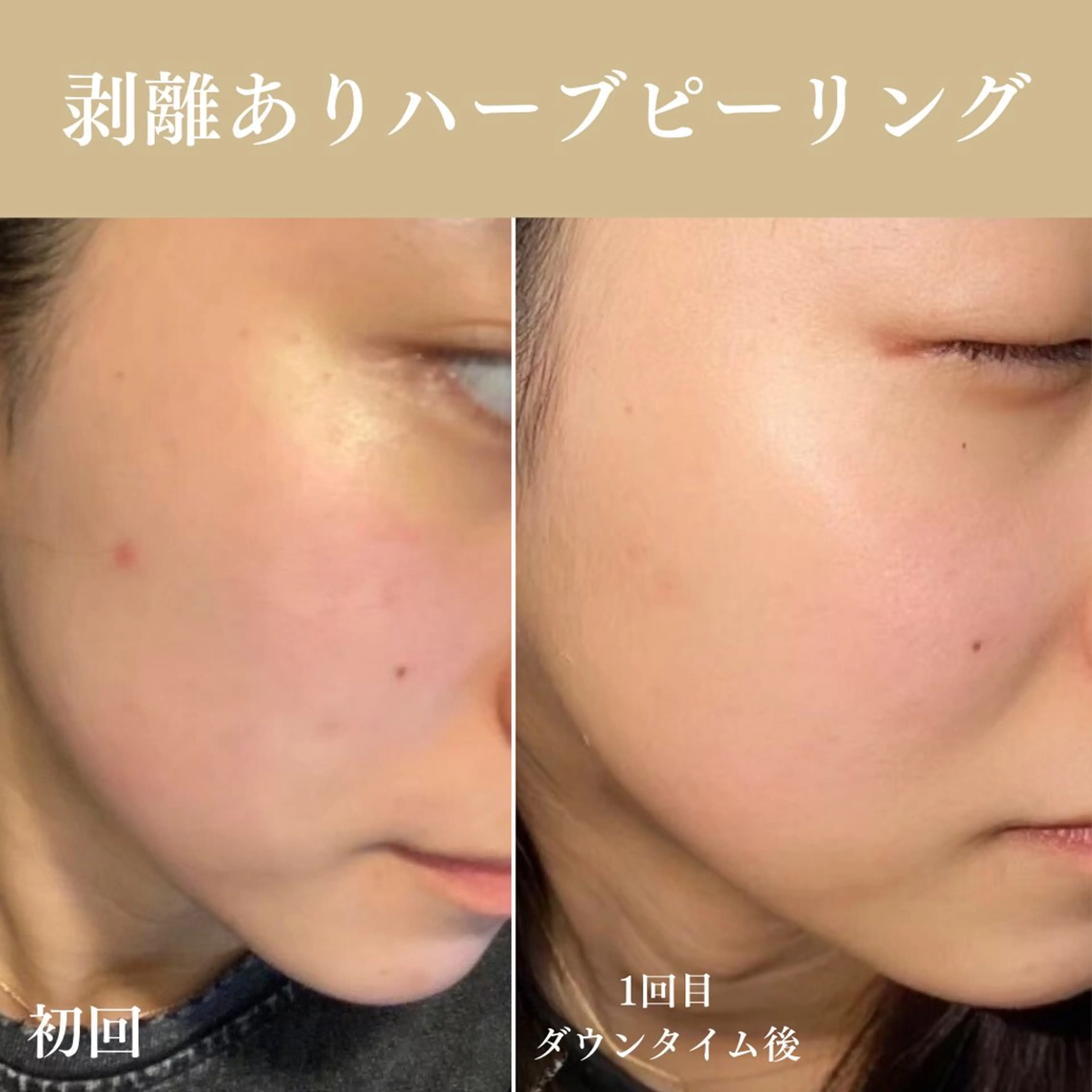 Oncebell. Bodymake&beautysalon所属・Oncebell. ワンベルのエステ・リラクイメージ