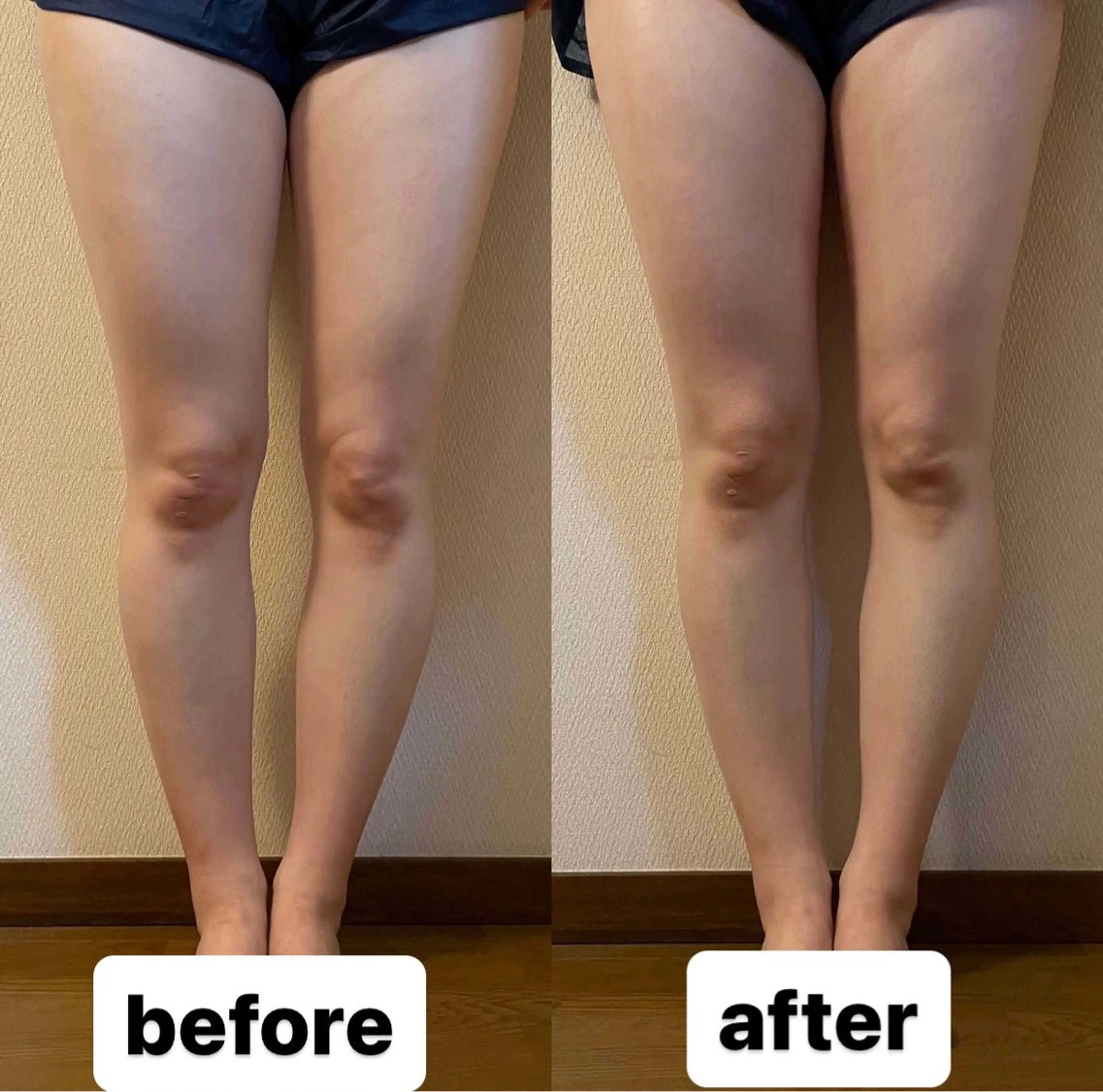 【平日限定】脚集中ケアコース60分+ドライヘッドスパ15分の写真