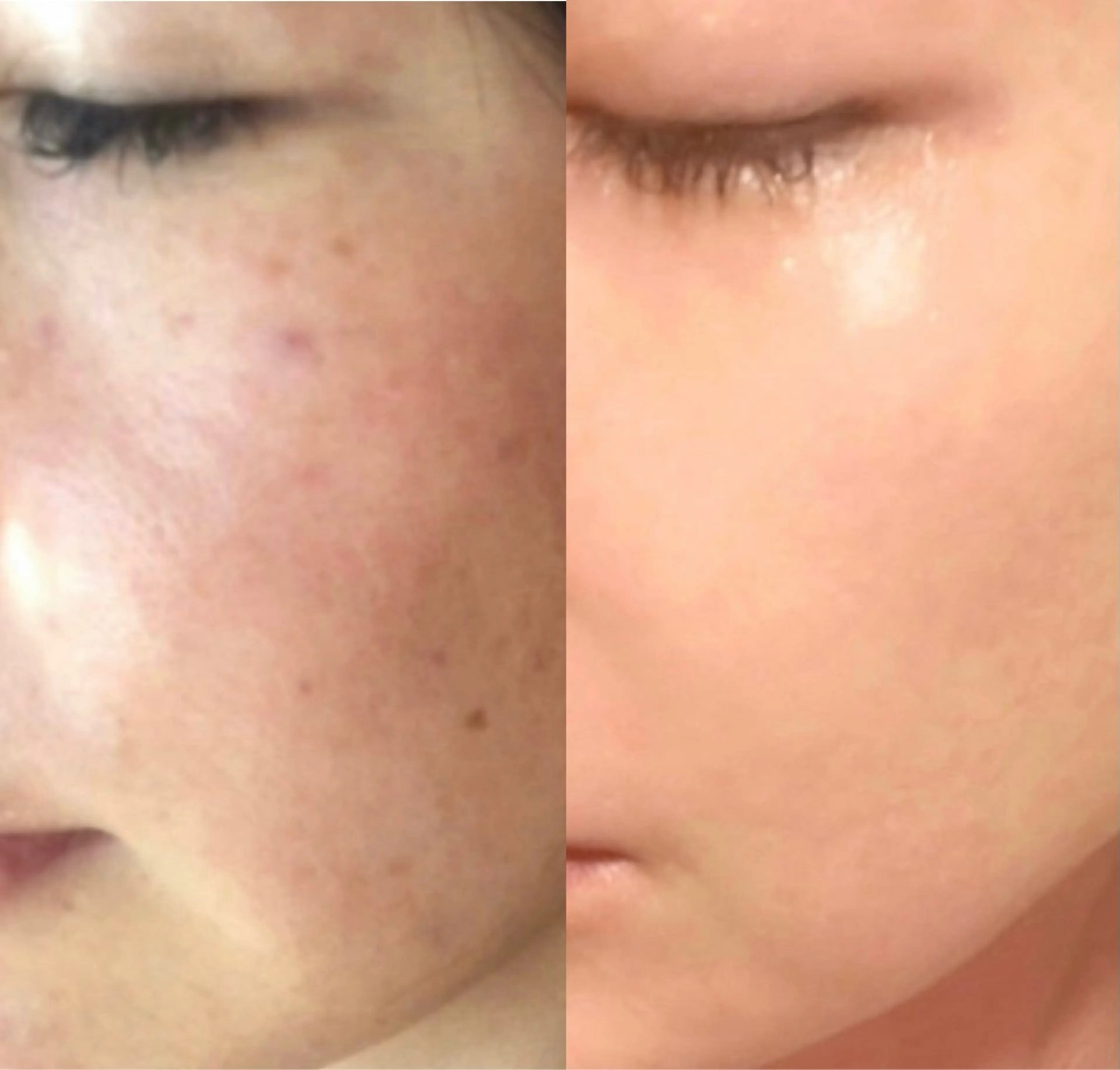 facial salon D 吉沢のエステ・リラクイメージ