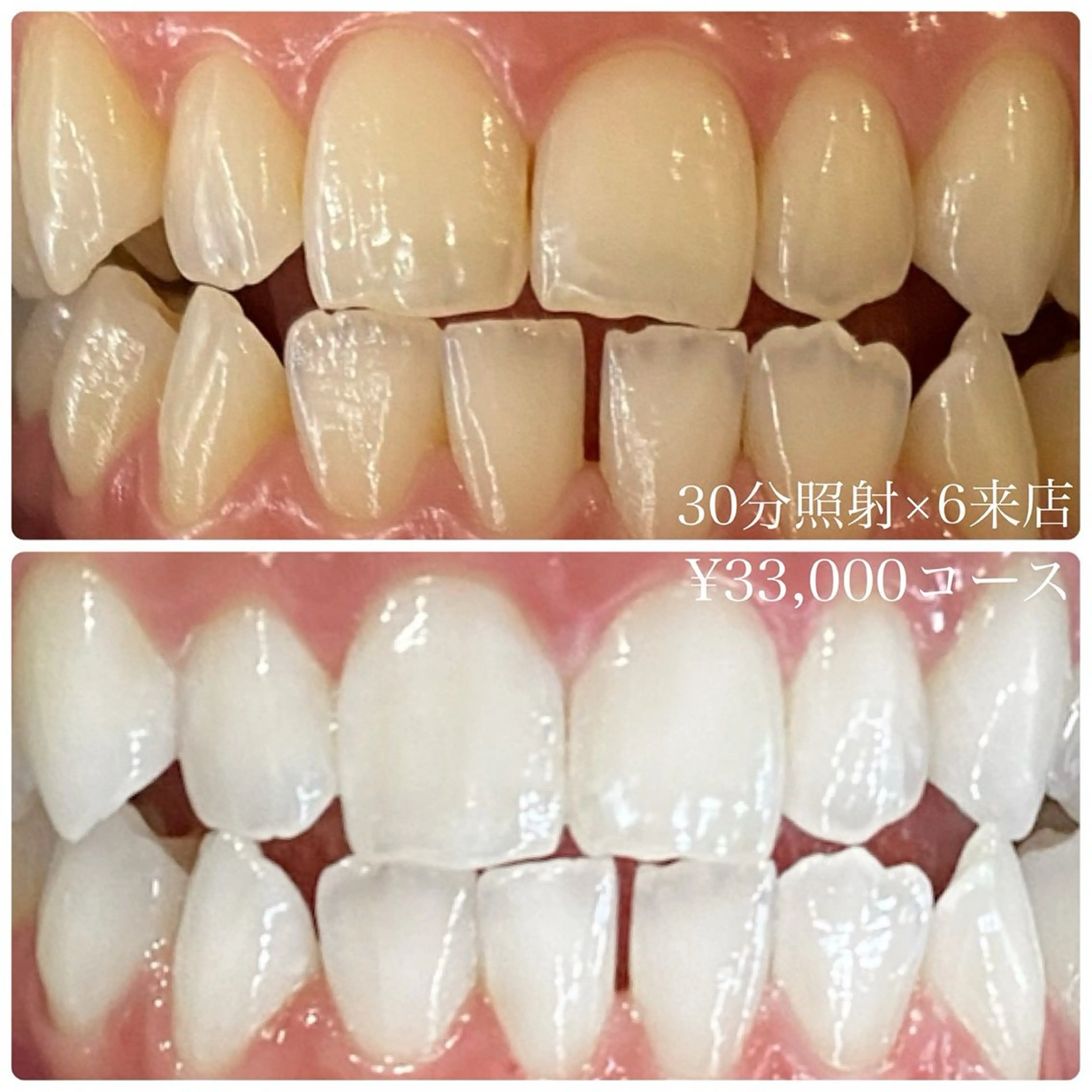 PLATINUM Beauty 横浜店所属・ホワイトニングルーム 横浜店のその他イメージ