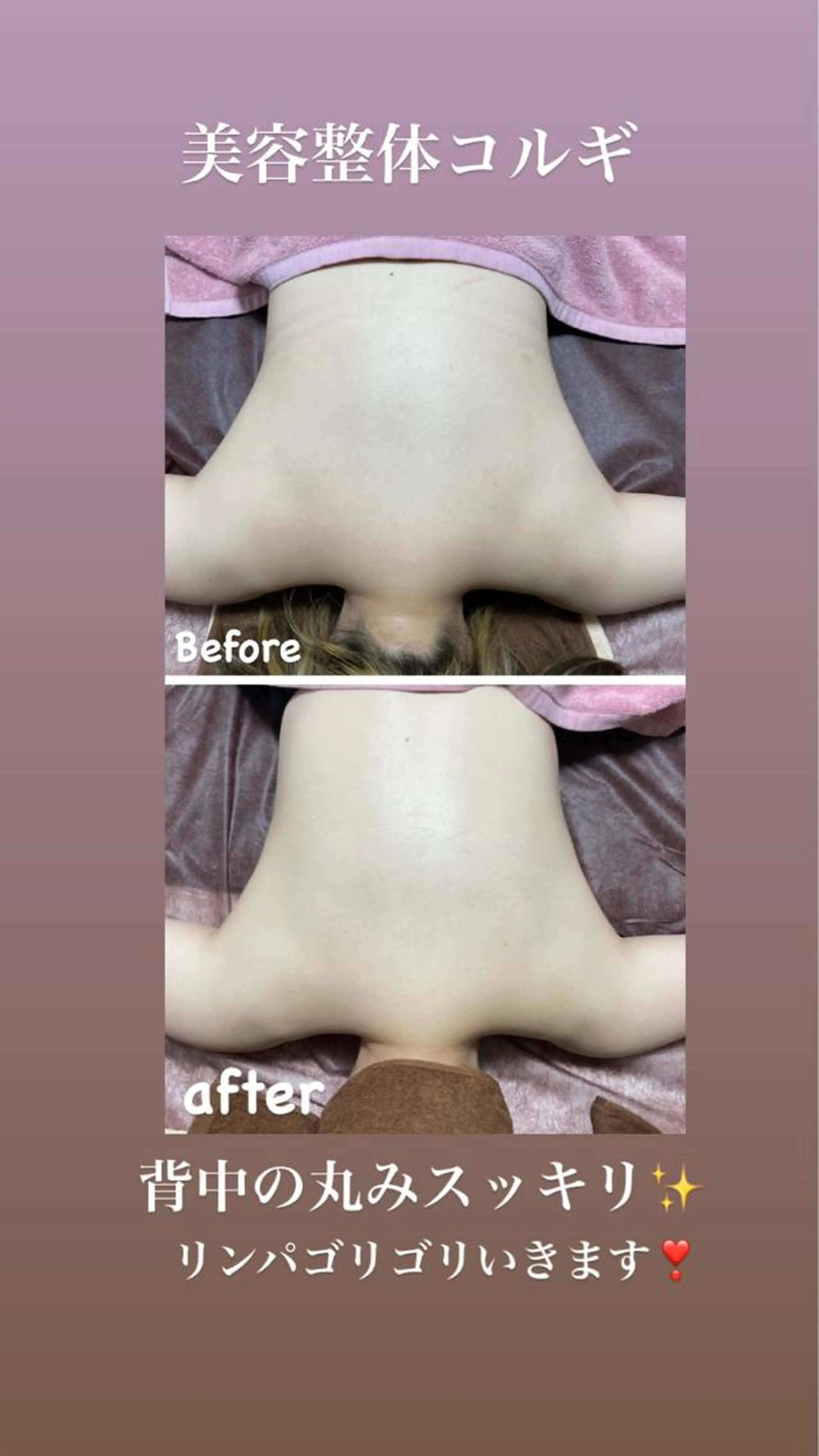 美容整体コルギの写真