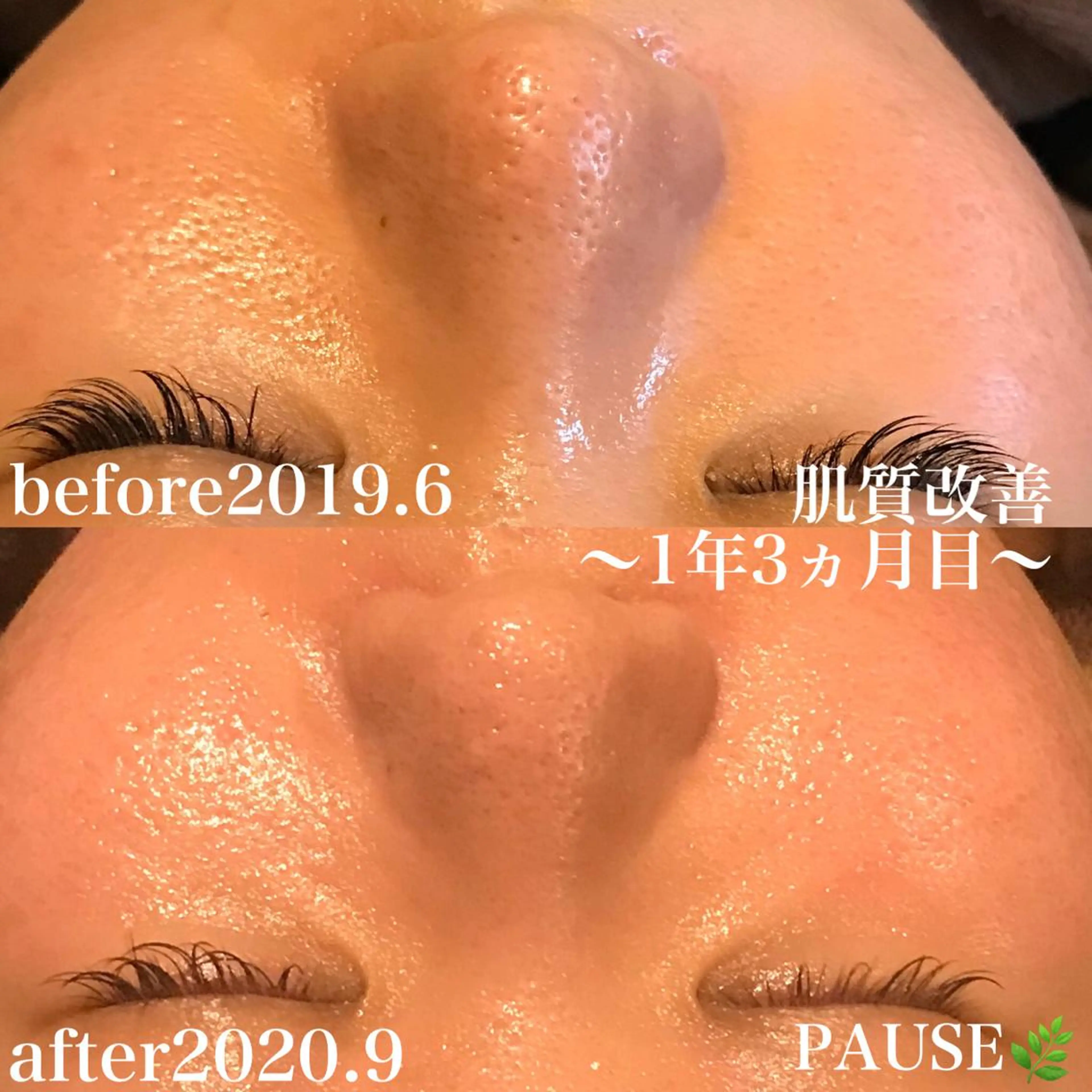 エステ 浜野 恵美のエステ・リラクイメージ