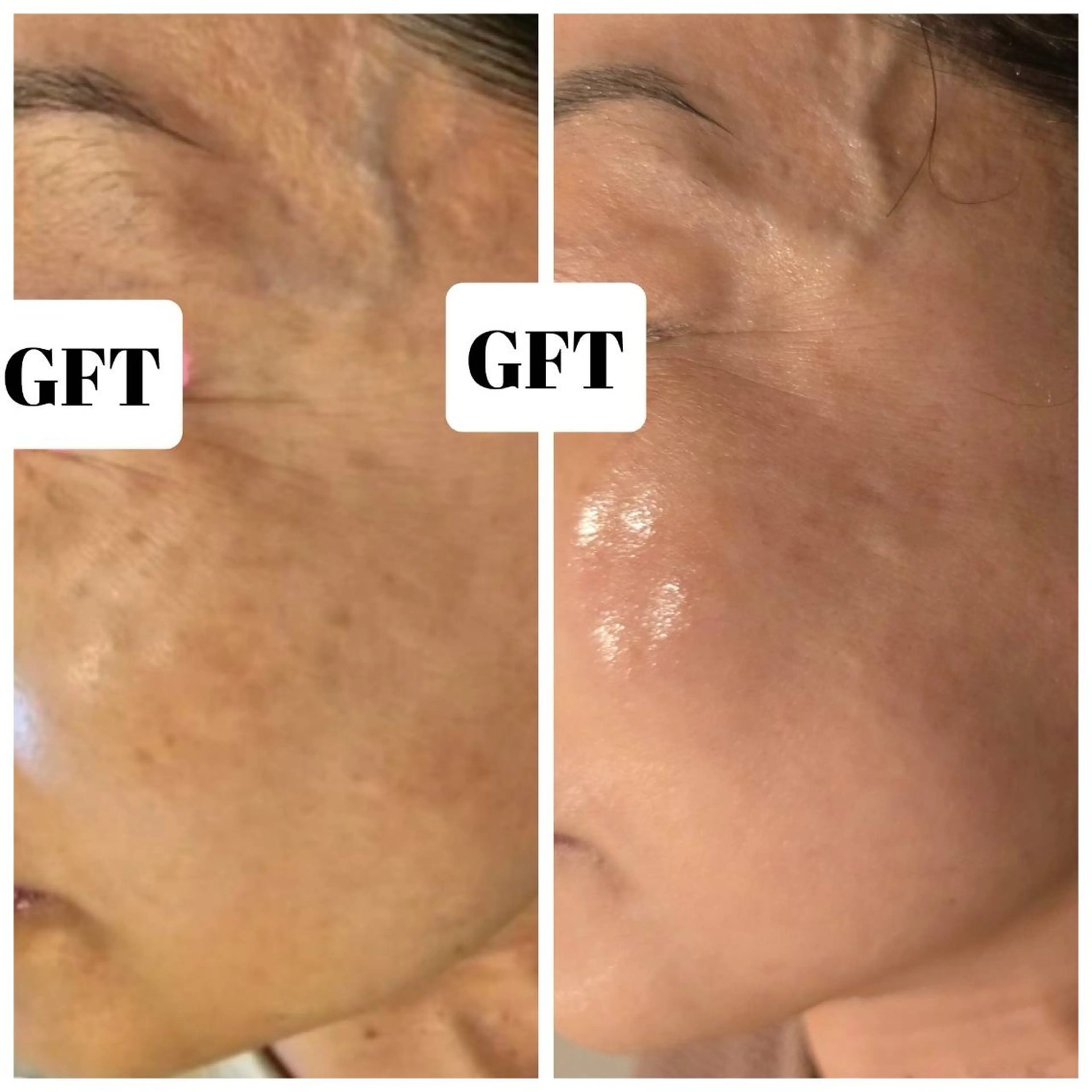 ilima NARUMIのエステ・リラクイメージ