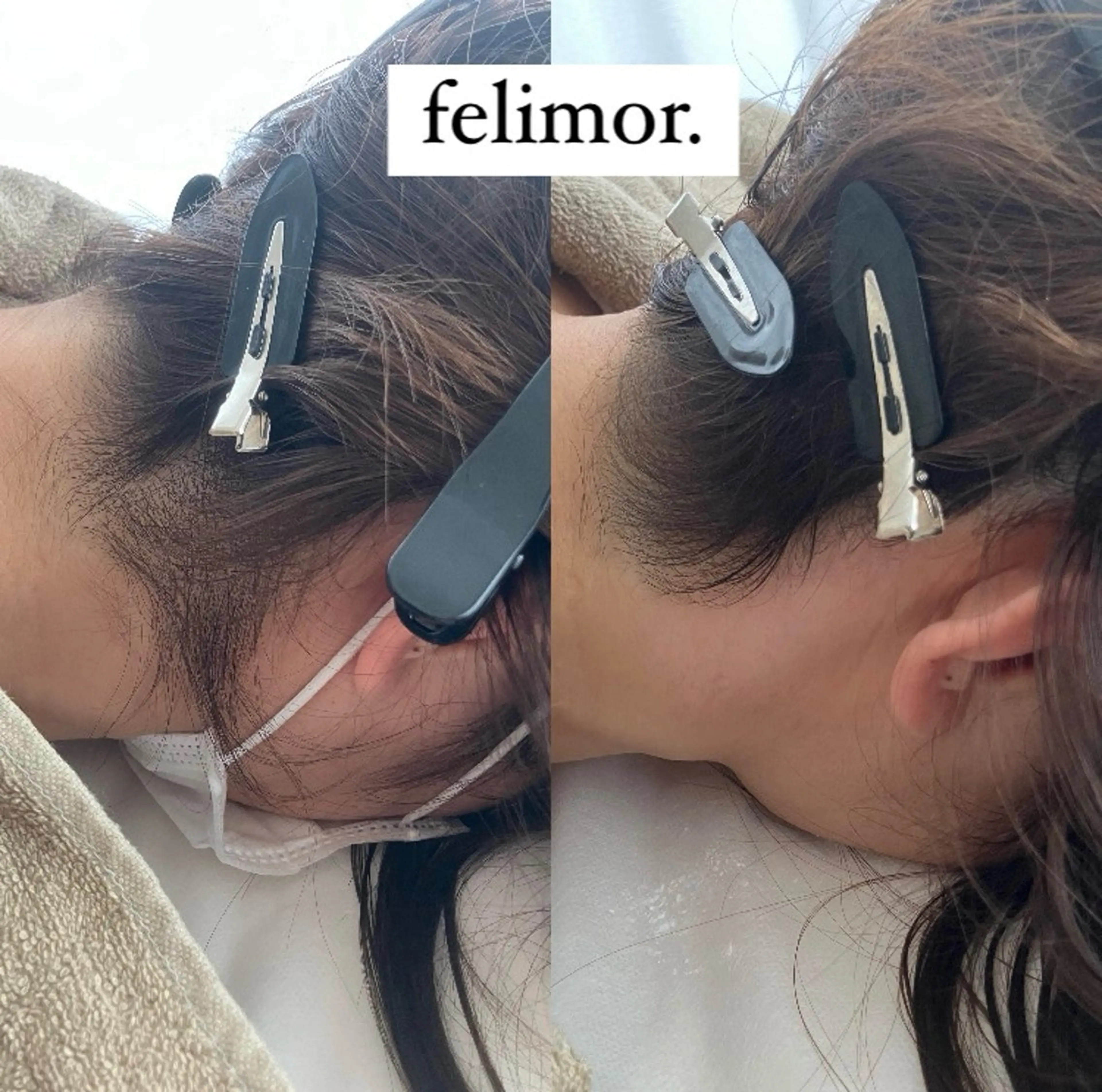 脱毛 Felimor.所属・Felimor. フェリモールのエステ・リラクイメージ