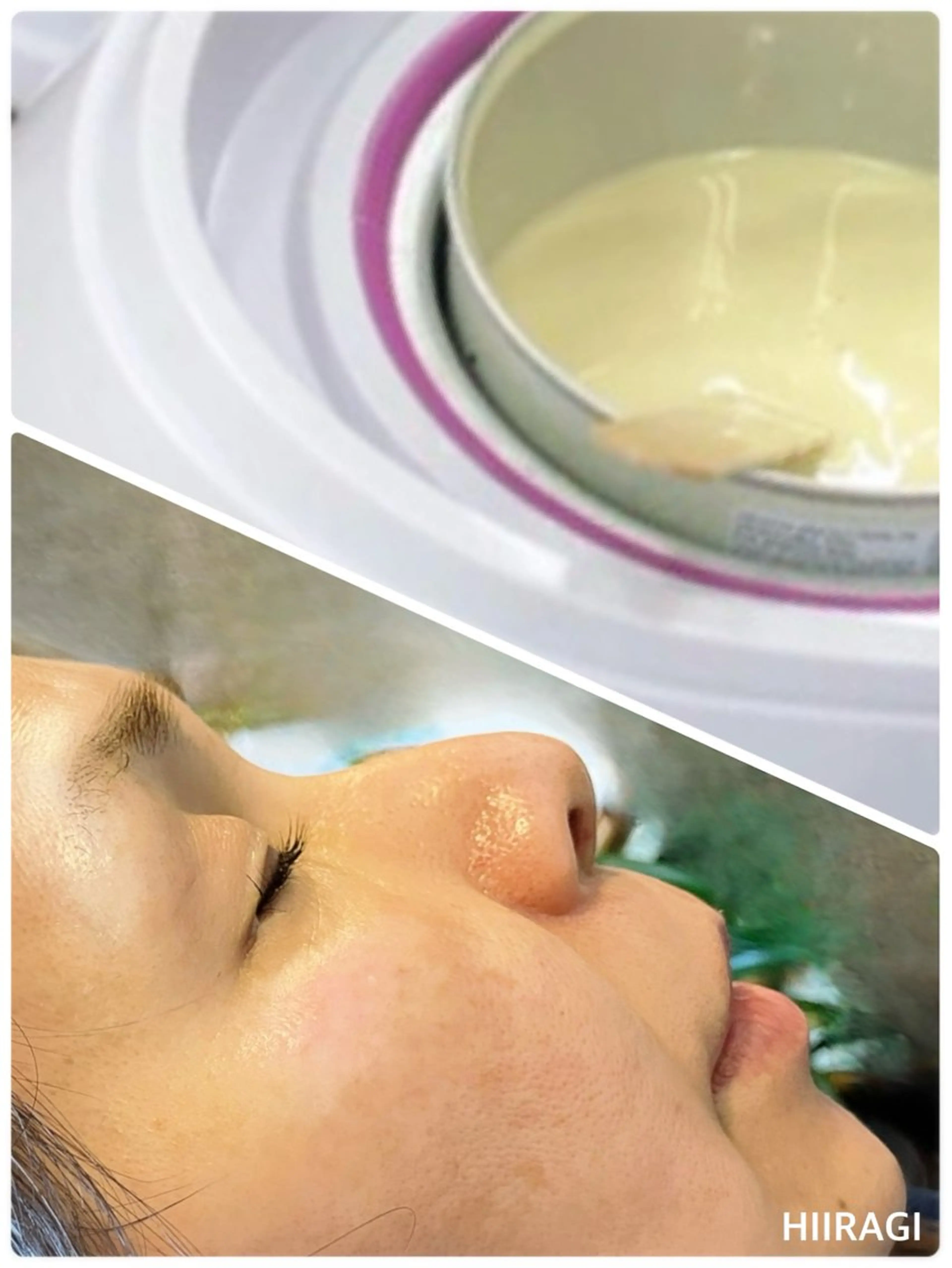 フェイスワックス（お顔の産毛、額、眉間、こめかみ、小鼻、もみあげ）トリートメント仕上げ✨期間限定の写真