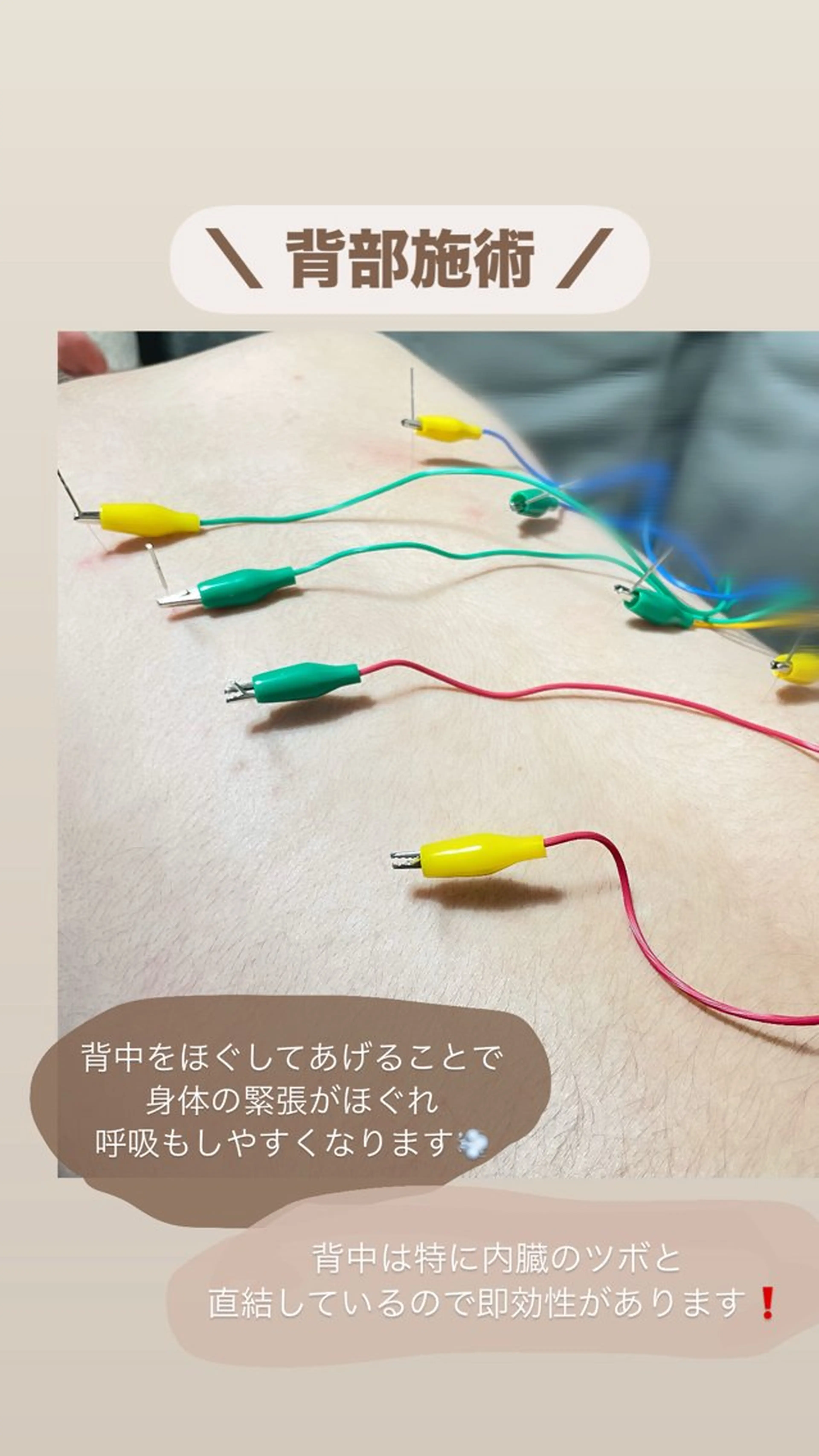 美容鍼/鍼灸 ここみ鍼灸院のエステ・リラクイメージ