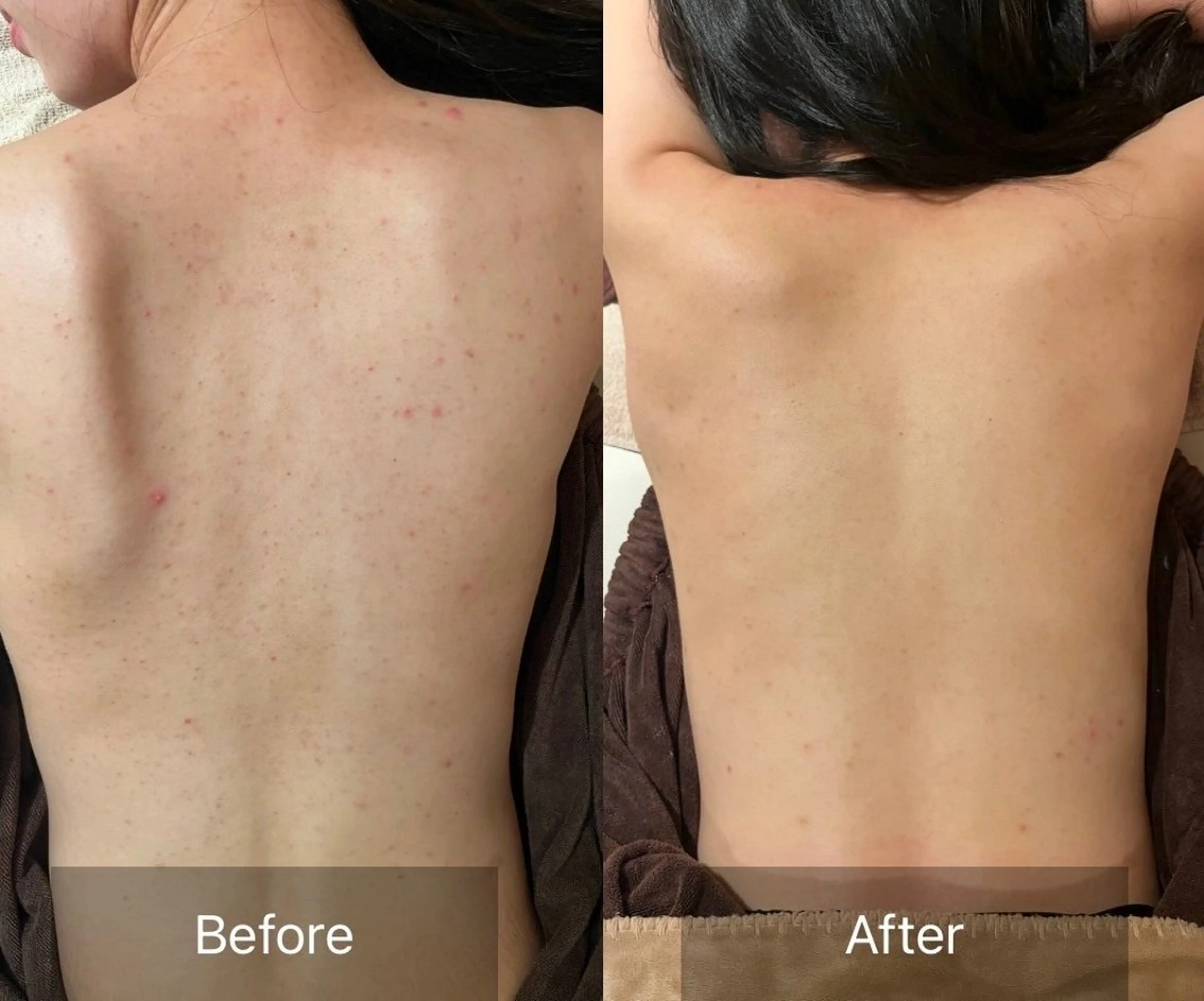 その他 for woman所属・森 美優のエステ・リラクイメージ