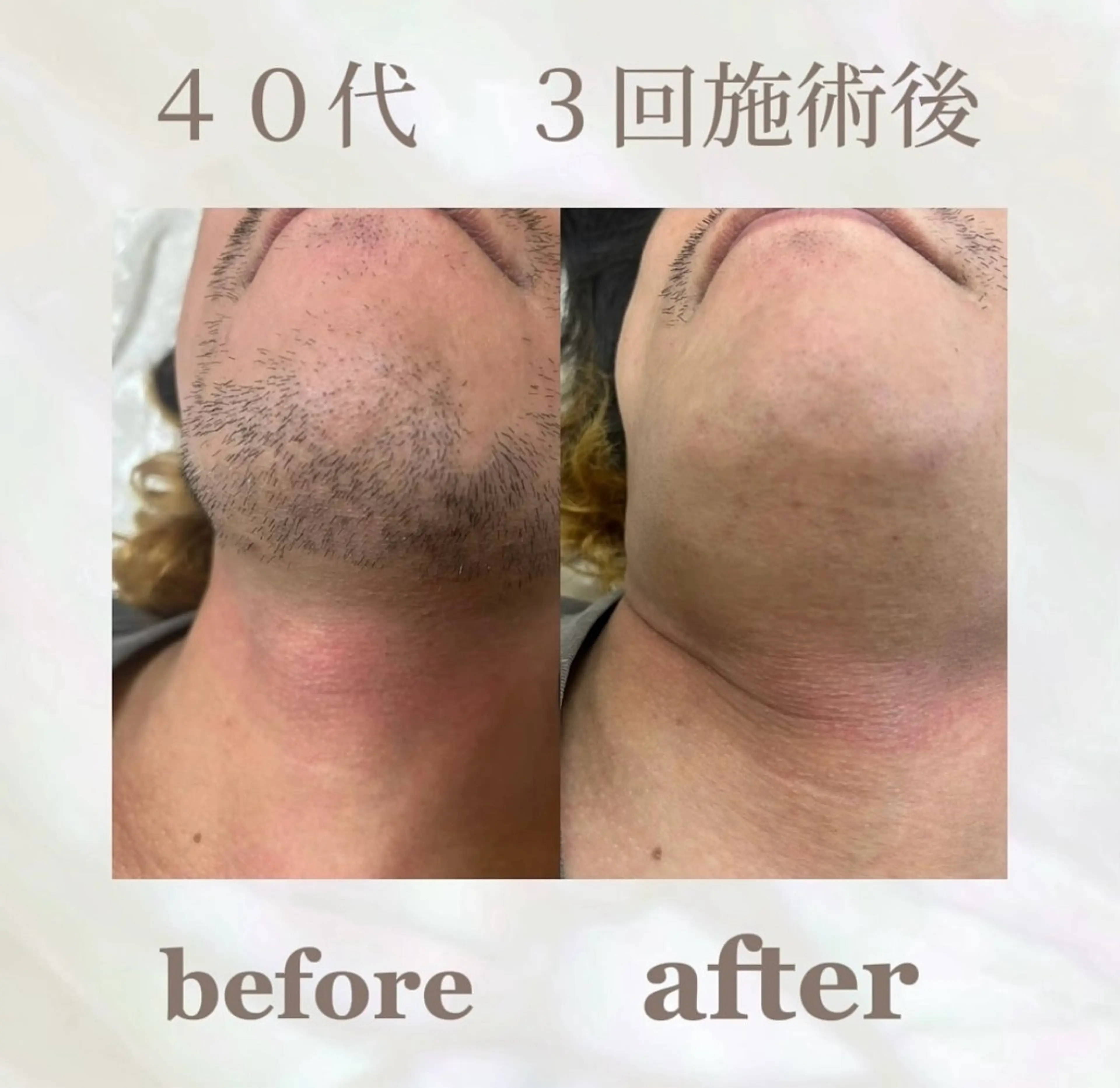 💠the4💠【脱毛特化サロン】所属・LED脱毛サロン 💐ayaのエステ・リラクイメージ