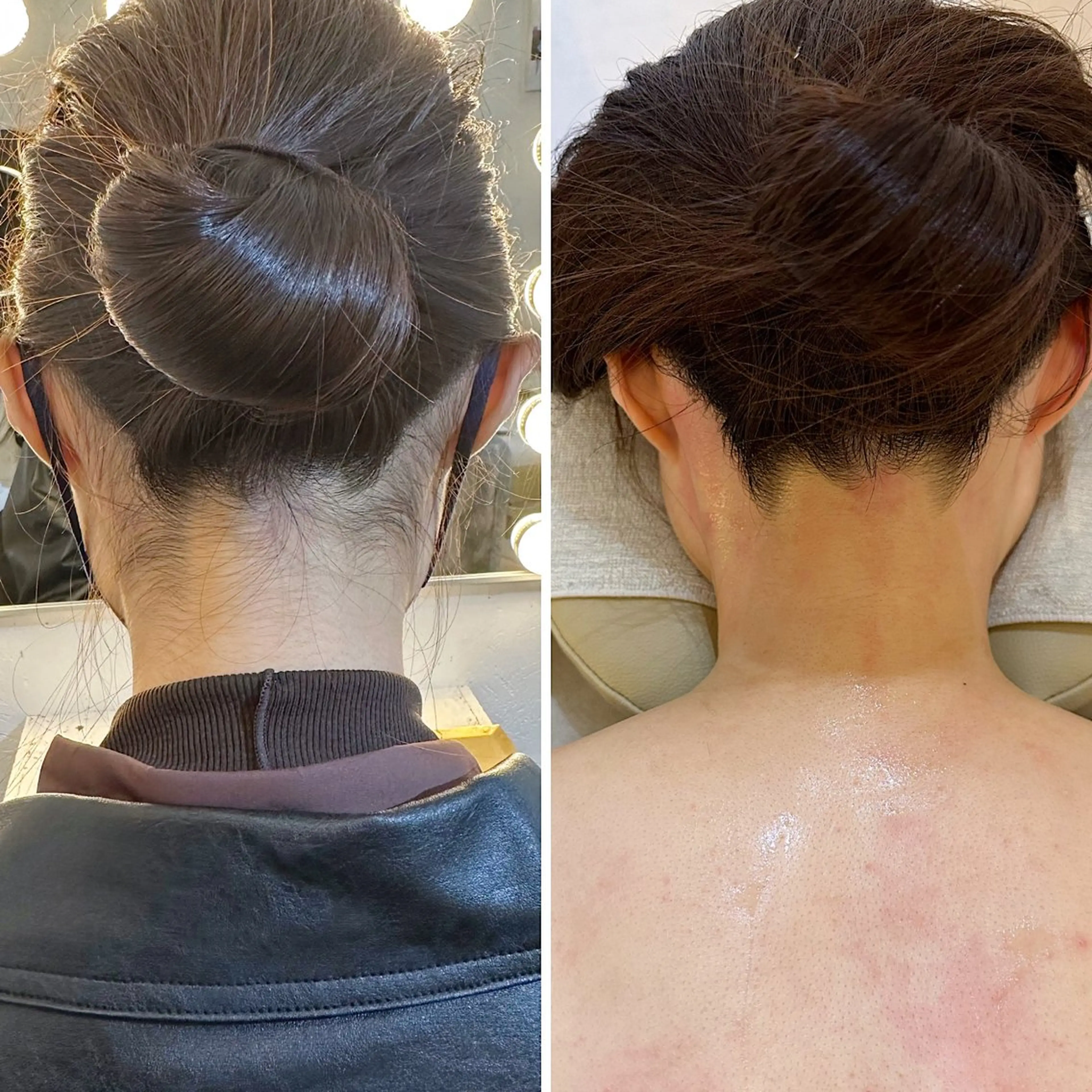 脱毛 うなじ脱毛/美肌脱毛 LABELのエステ・リラクイメージ