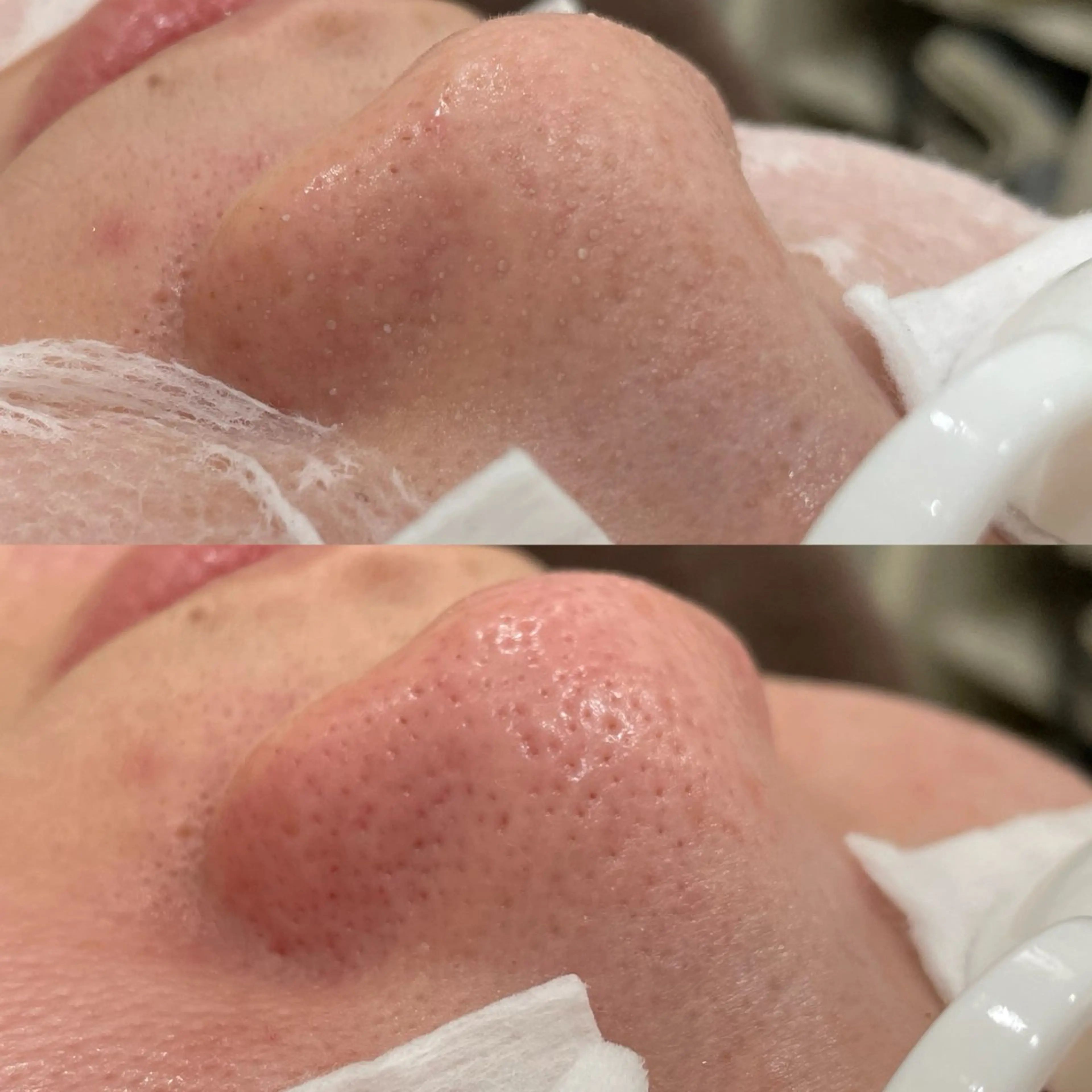 エステ エステサロンTug高知駅前店所属・Tug 高知駅前店/ NANAMIのその他イメージ