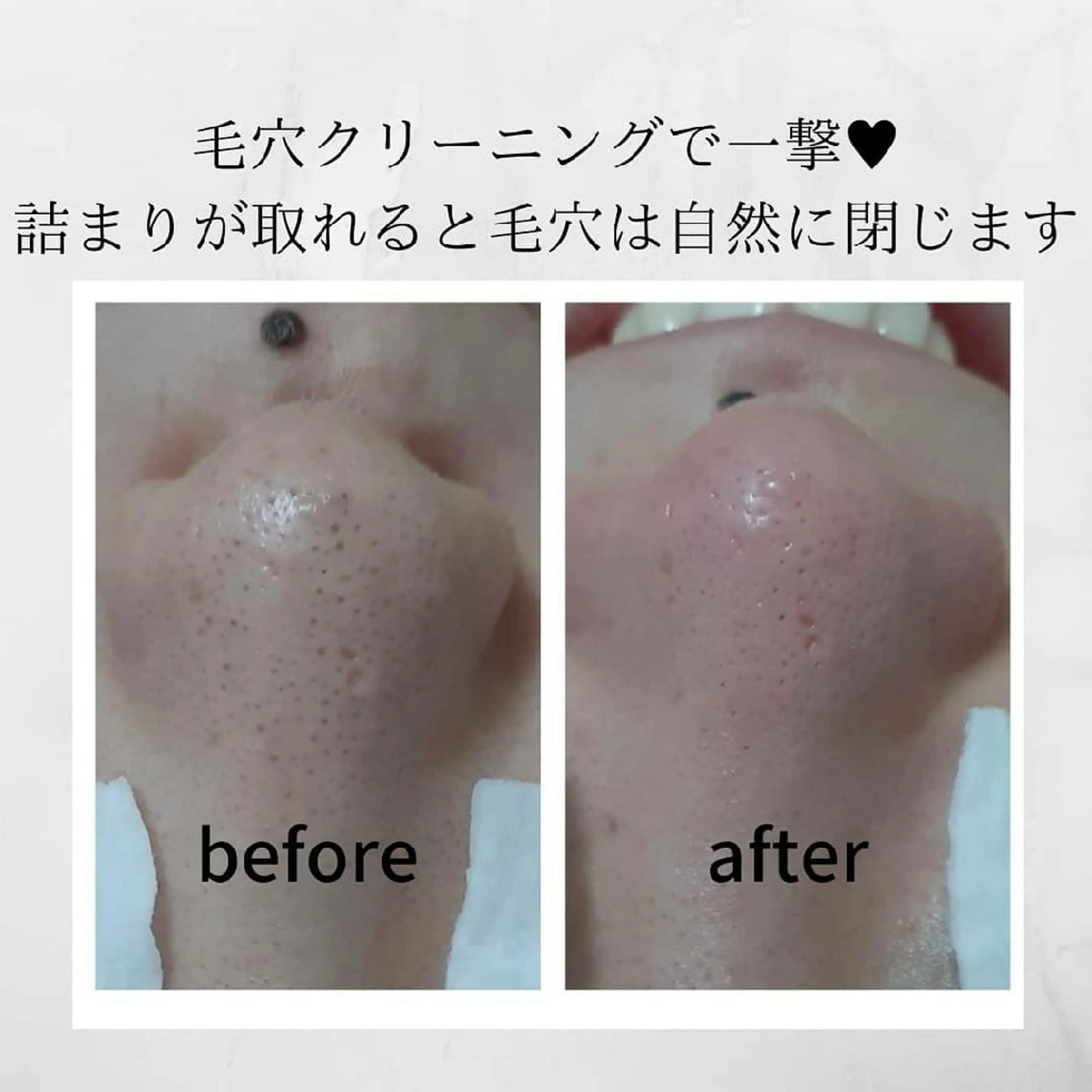 その他 毛穴ケア・肌質改善 徳川のエステ・リラクイメージ