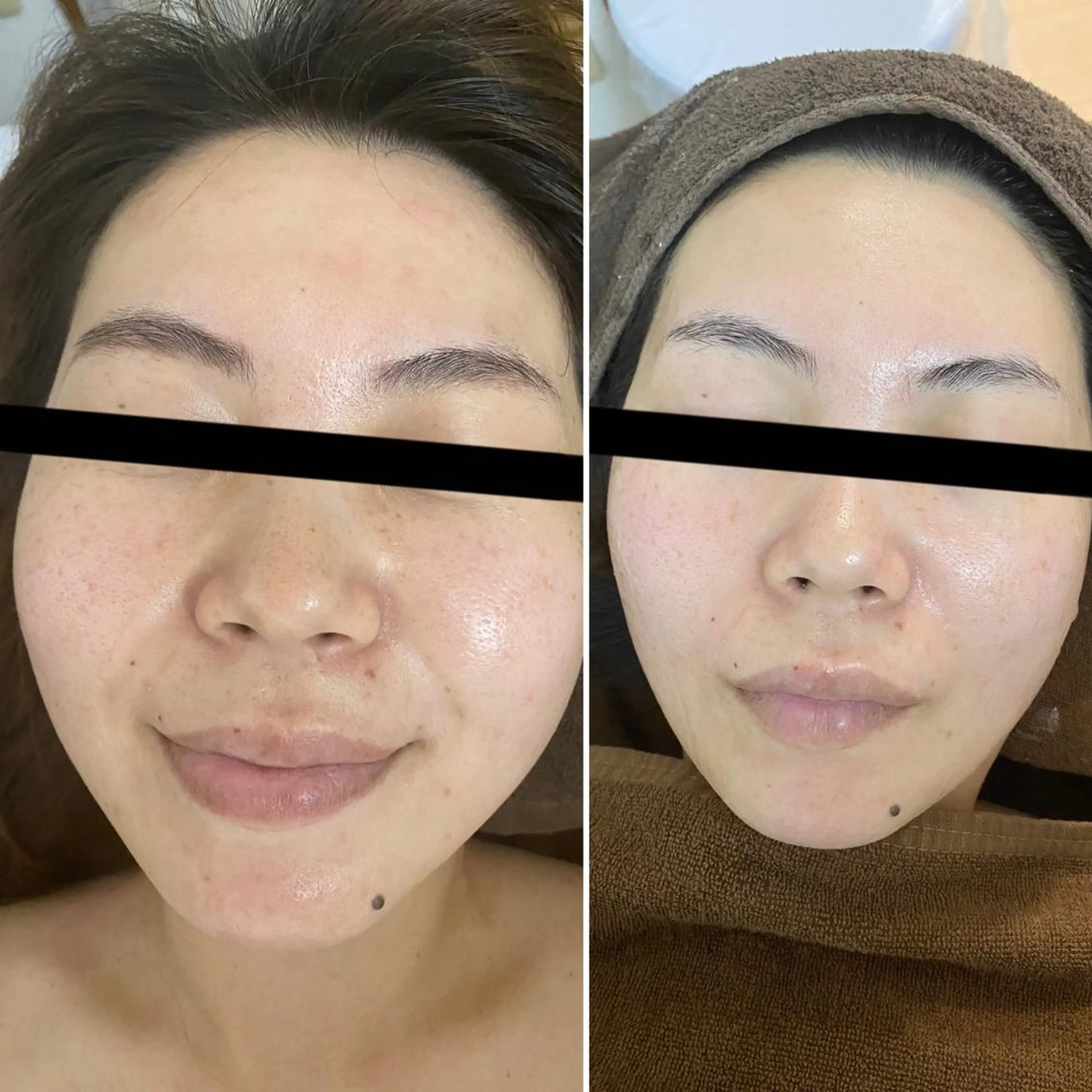 エステ total beauty salon Raffoler所属・Raffoler りさのエステ・リラクイメージ