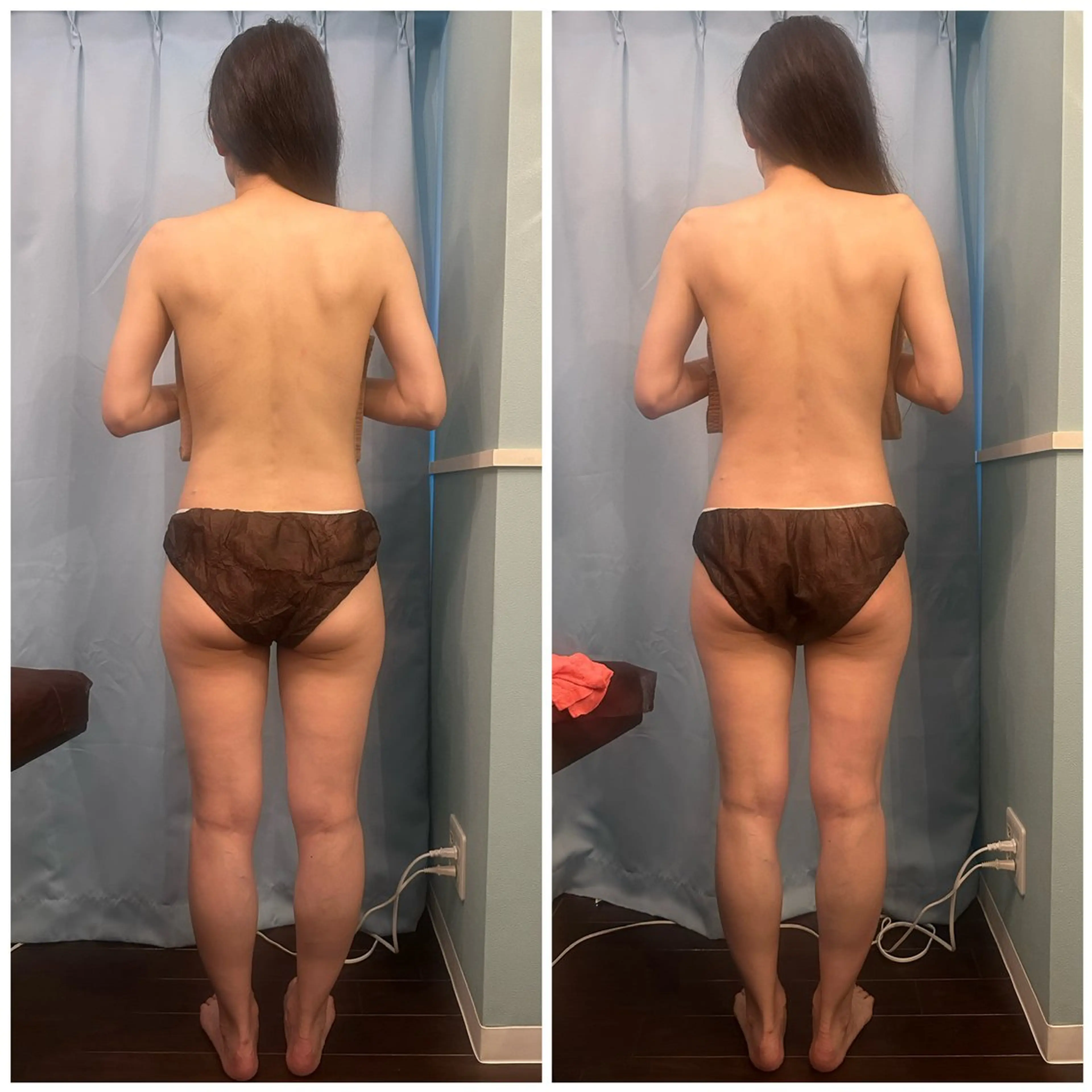 ヒップアップ・足のむくみ撃退👀全身リンパトリートメント+ お尻脚痩せ（80分）の写真