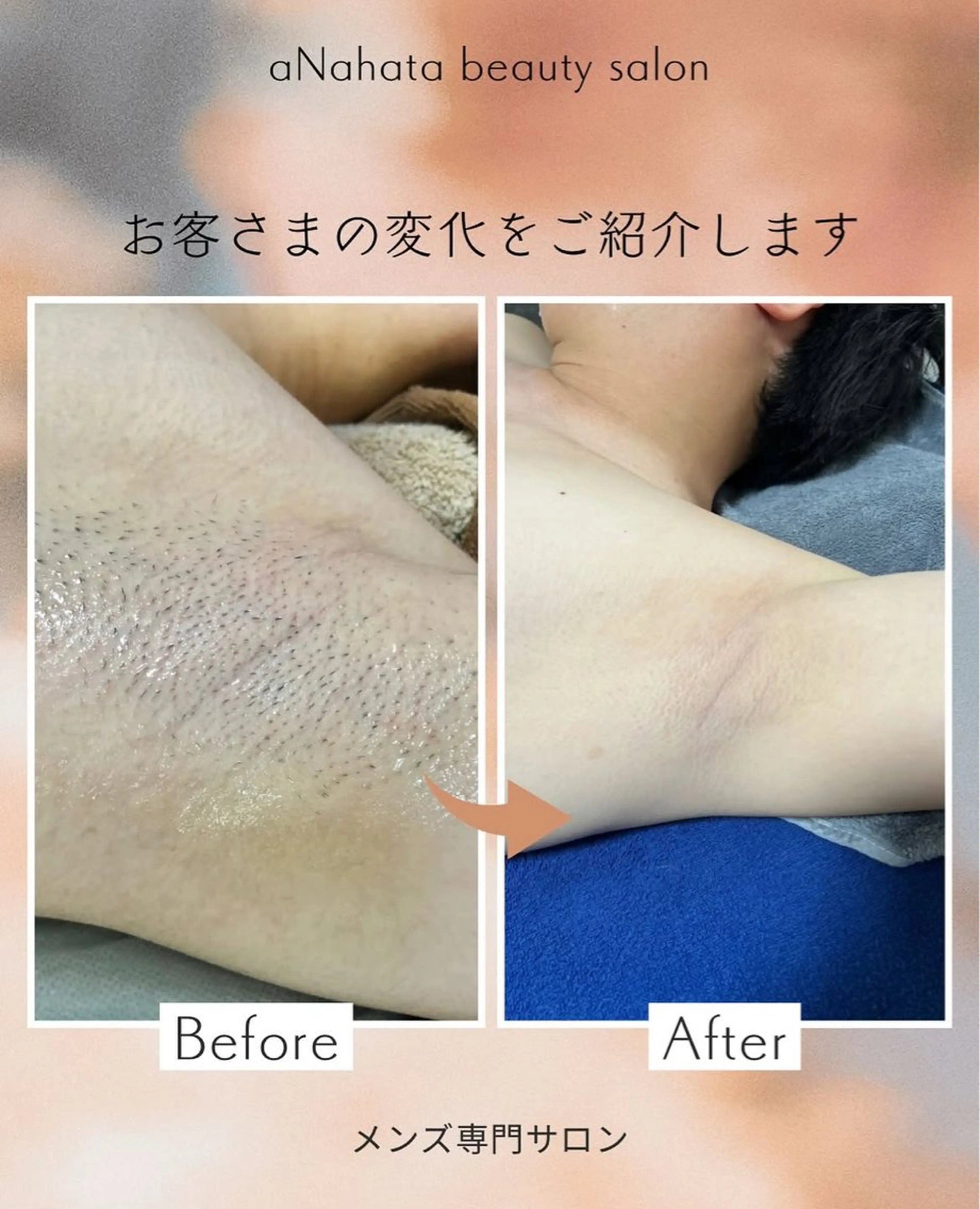 メンズ aNahata beauty salon所属・田中 菜月のエステ・リラクイメージ