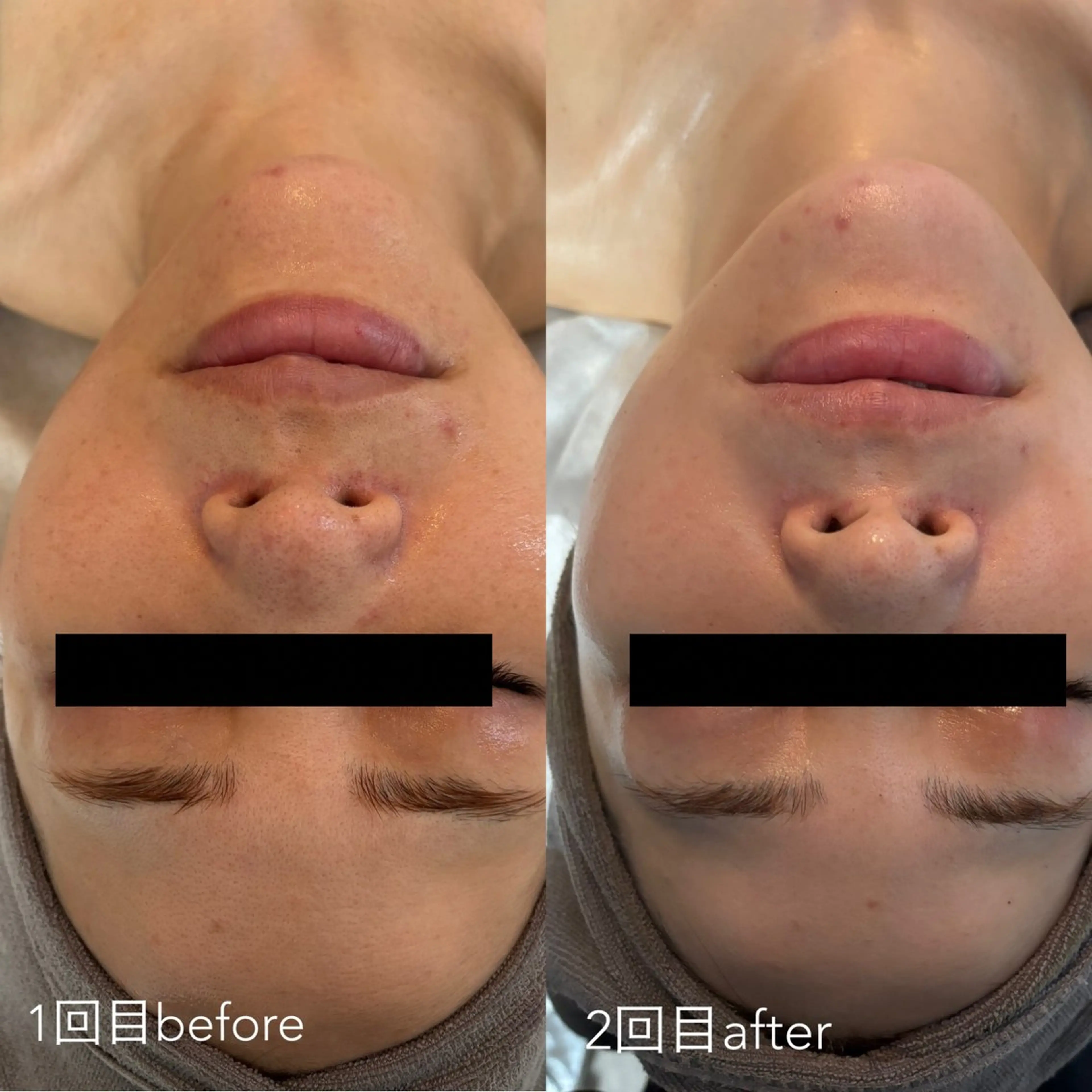 エステティックサロン Liente(リアンテ)所属・Hashimoto .のエステ・リラクイメージ