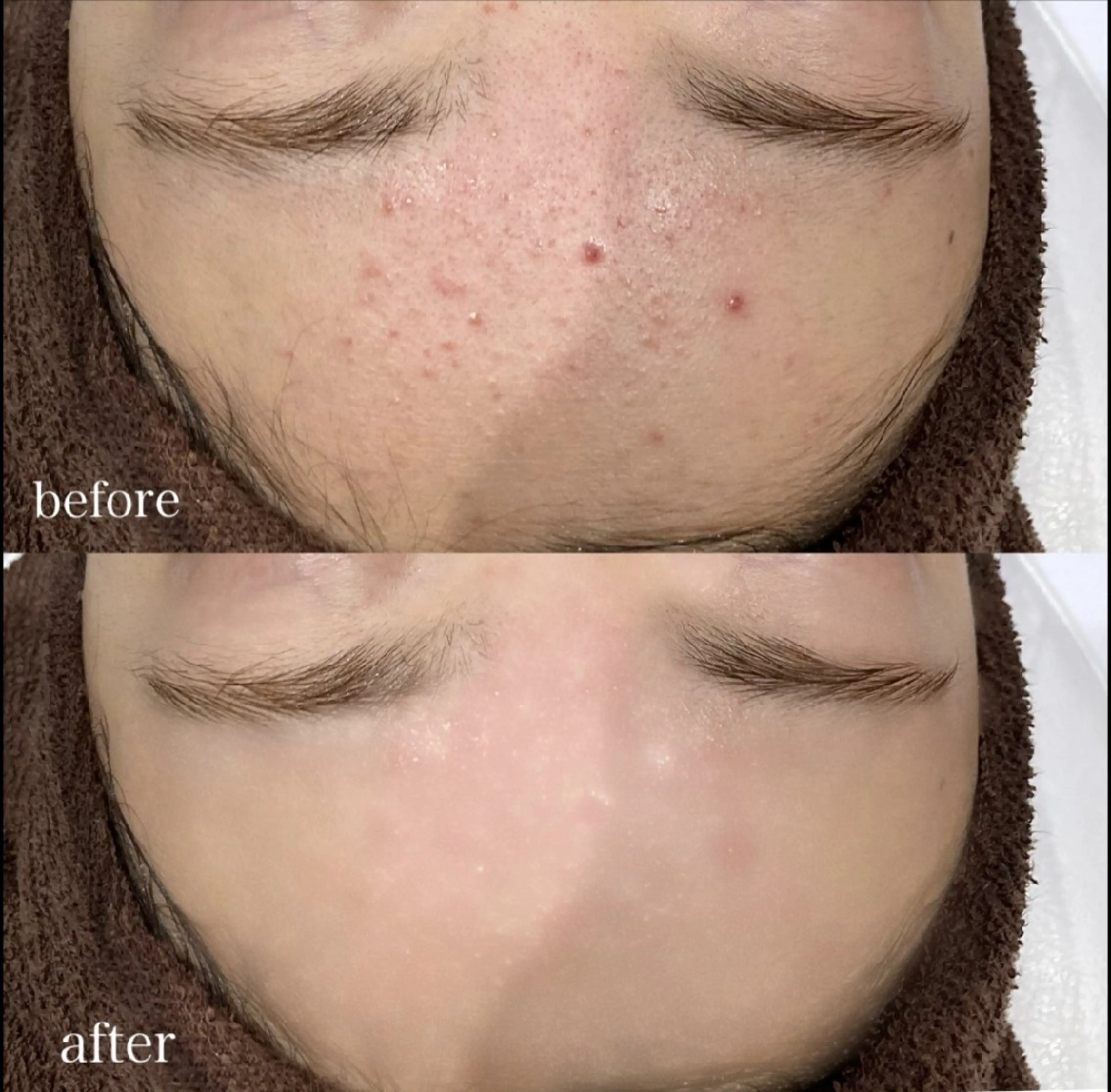 エステ DahliaBeauty ダリアビューティー所属・Dahlia 痩身 フェイシャル 中村のエステ・リラクイメージ