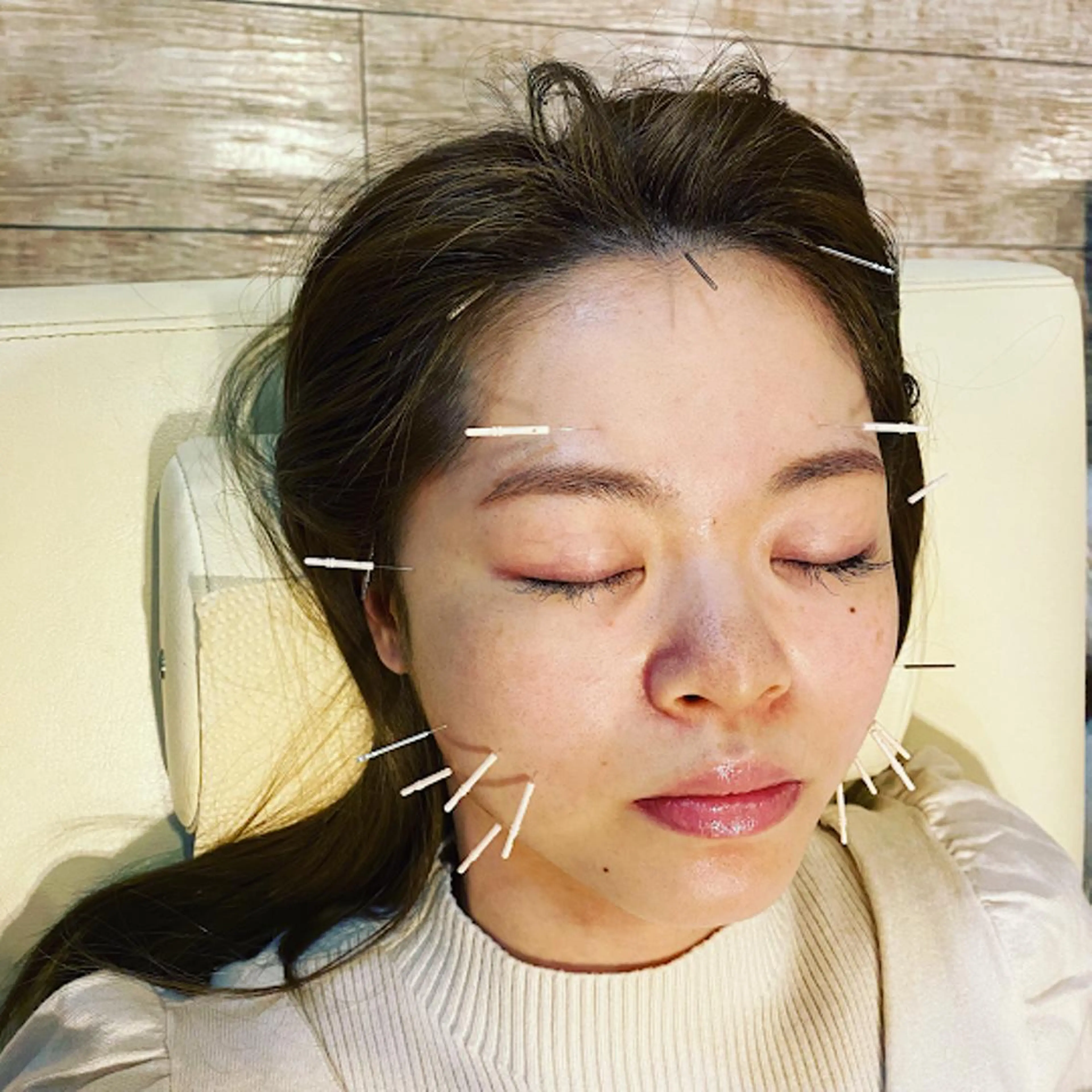 むくみたるみ専門☆ 美容鍼・小顔矯正のエステ・リラクイメージ
