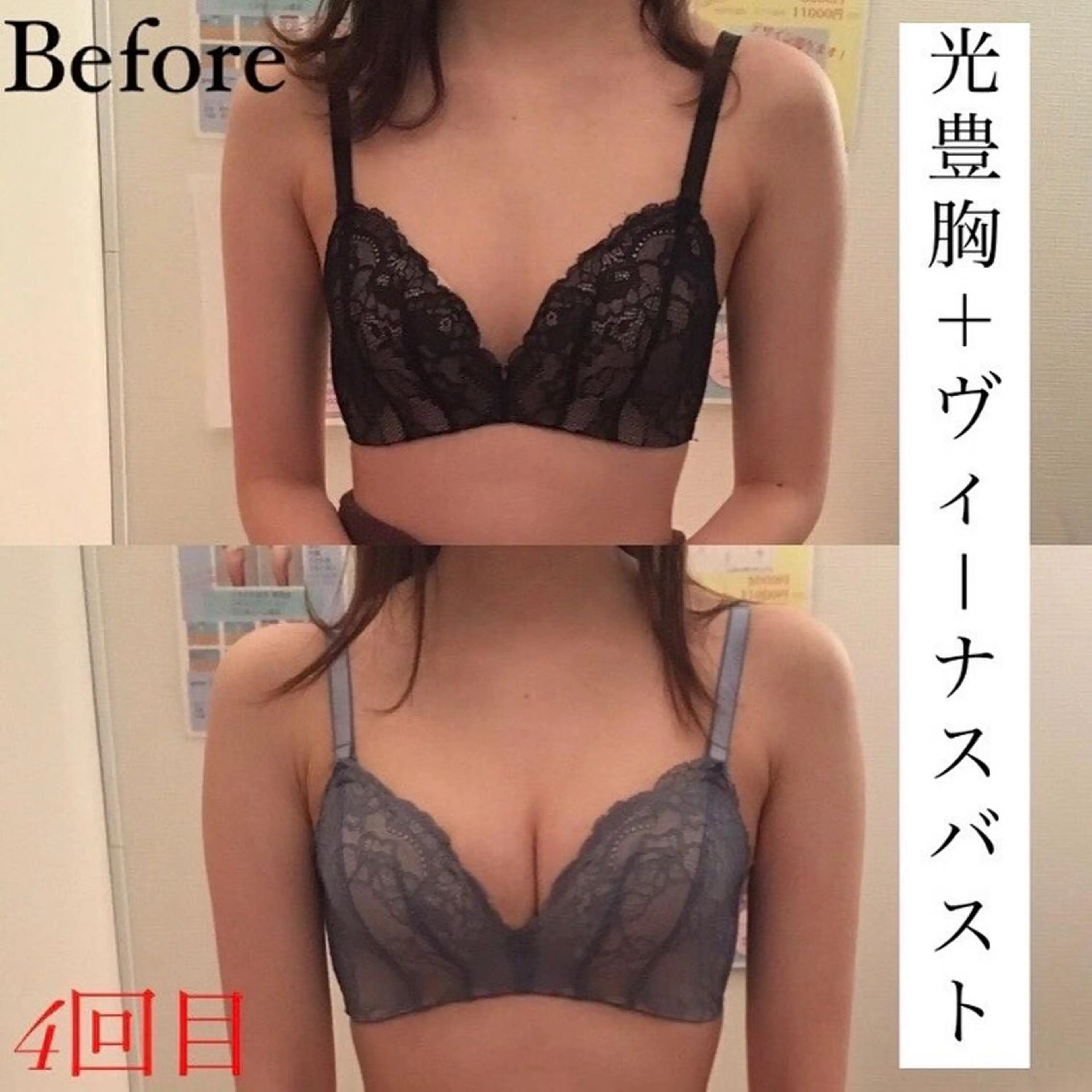 ミディアム カラー パーマ ヘアアレンジ メンズ キッズ ネイル マツエク・マツパ アイブロウ ヴィーナス 関内店のエステ・リラクイメージ